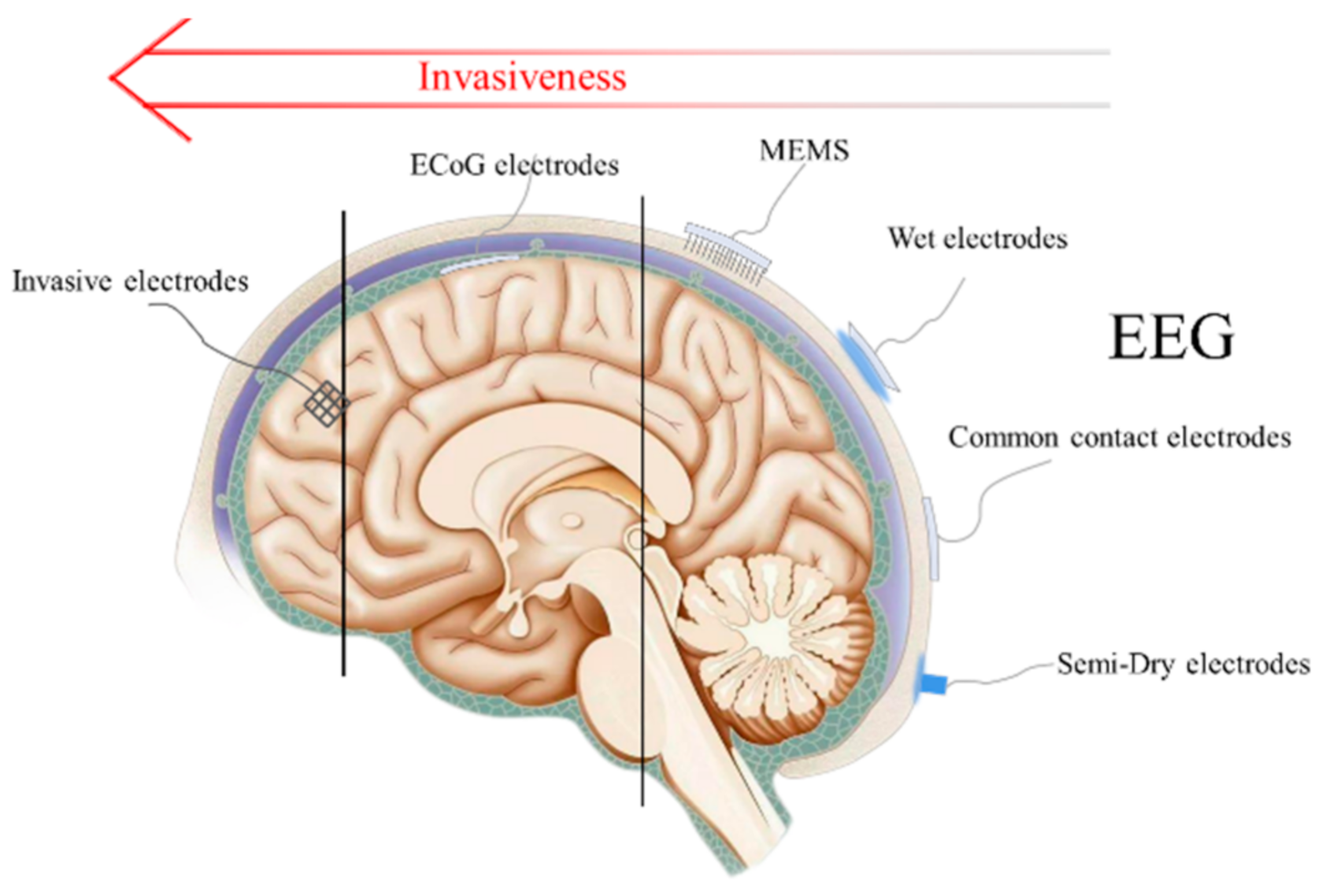 Micromachines Free FullText State of the Art of NonInvasive