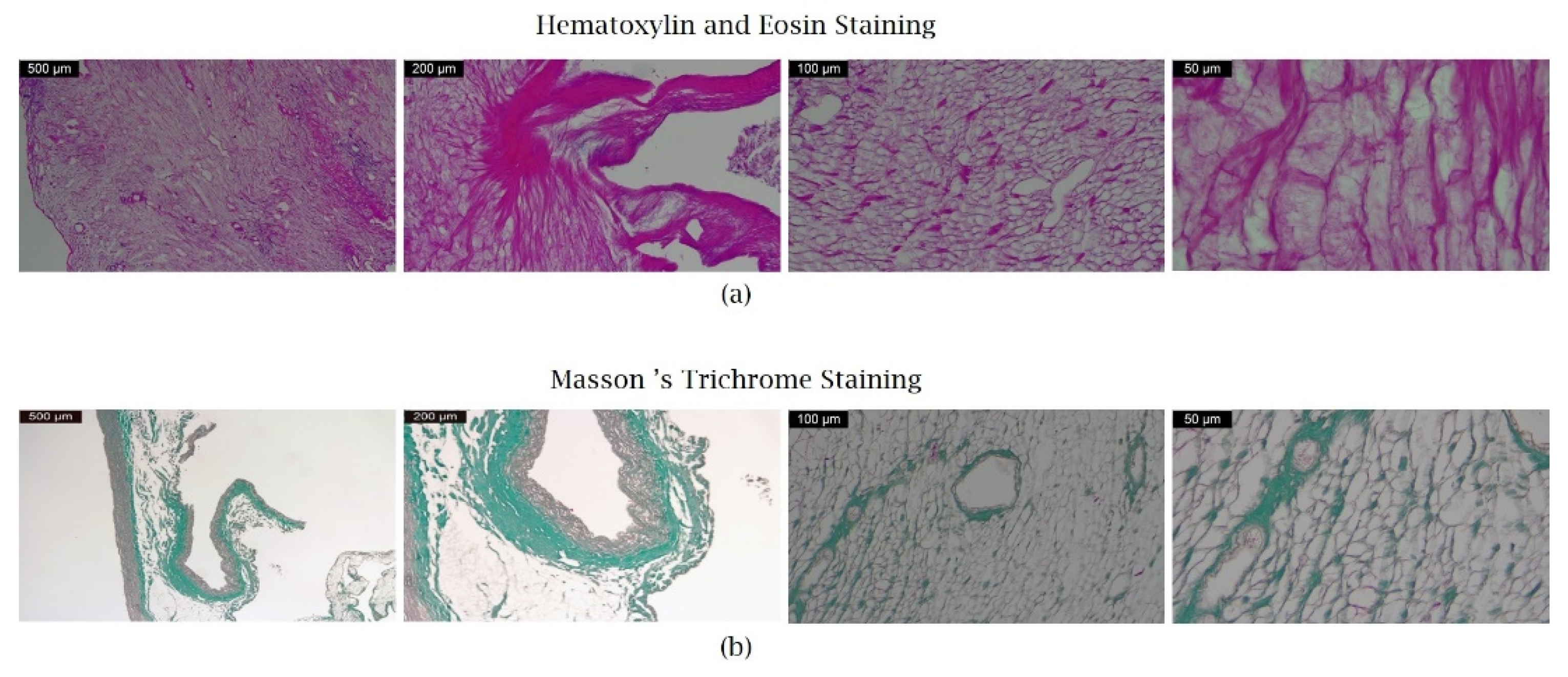 Micromachines 13 00079 g011