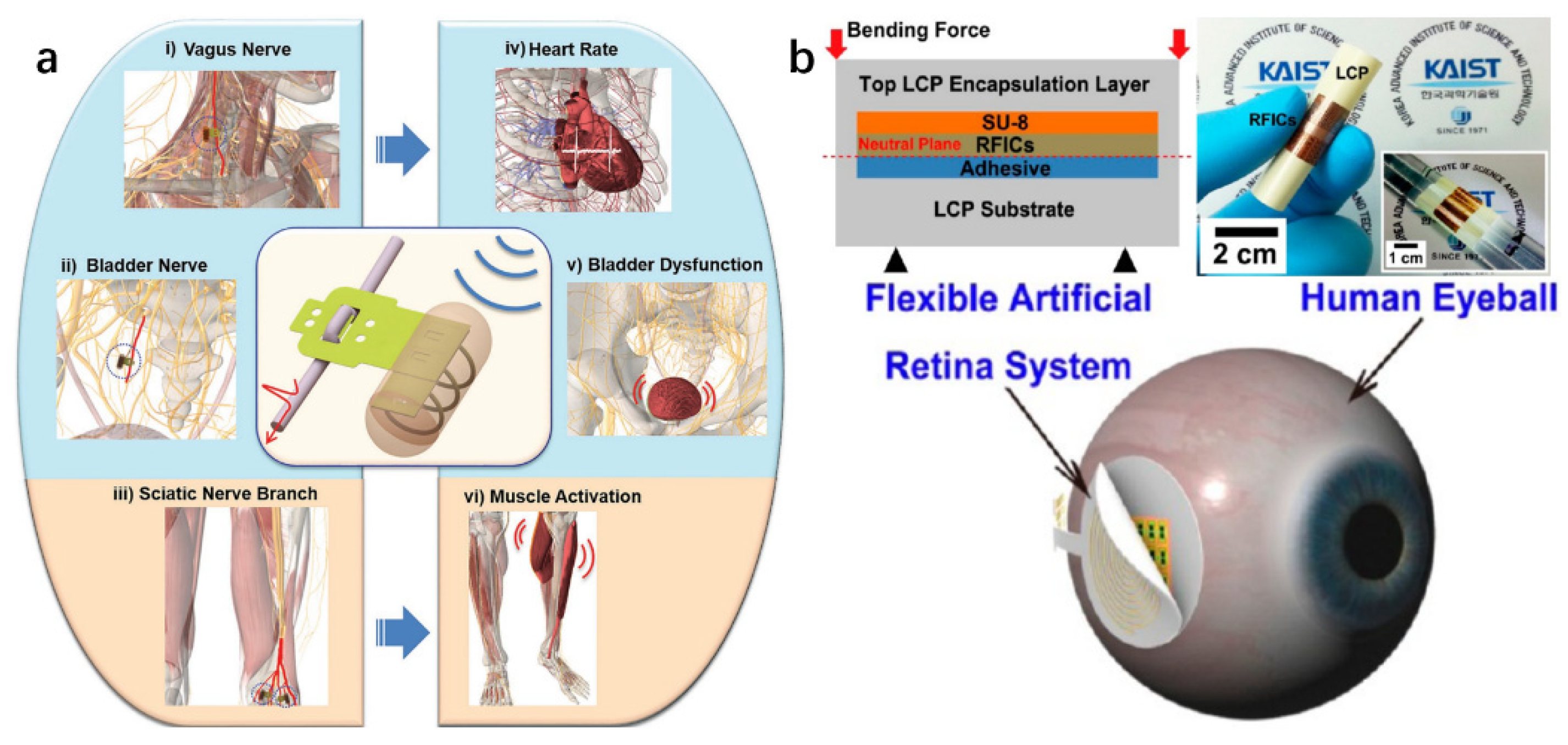 Micromachines 13 00386 g003