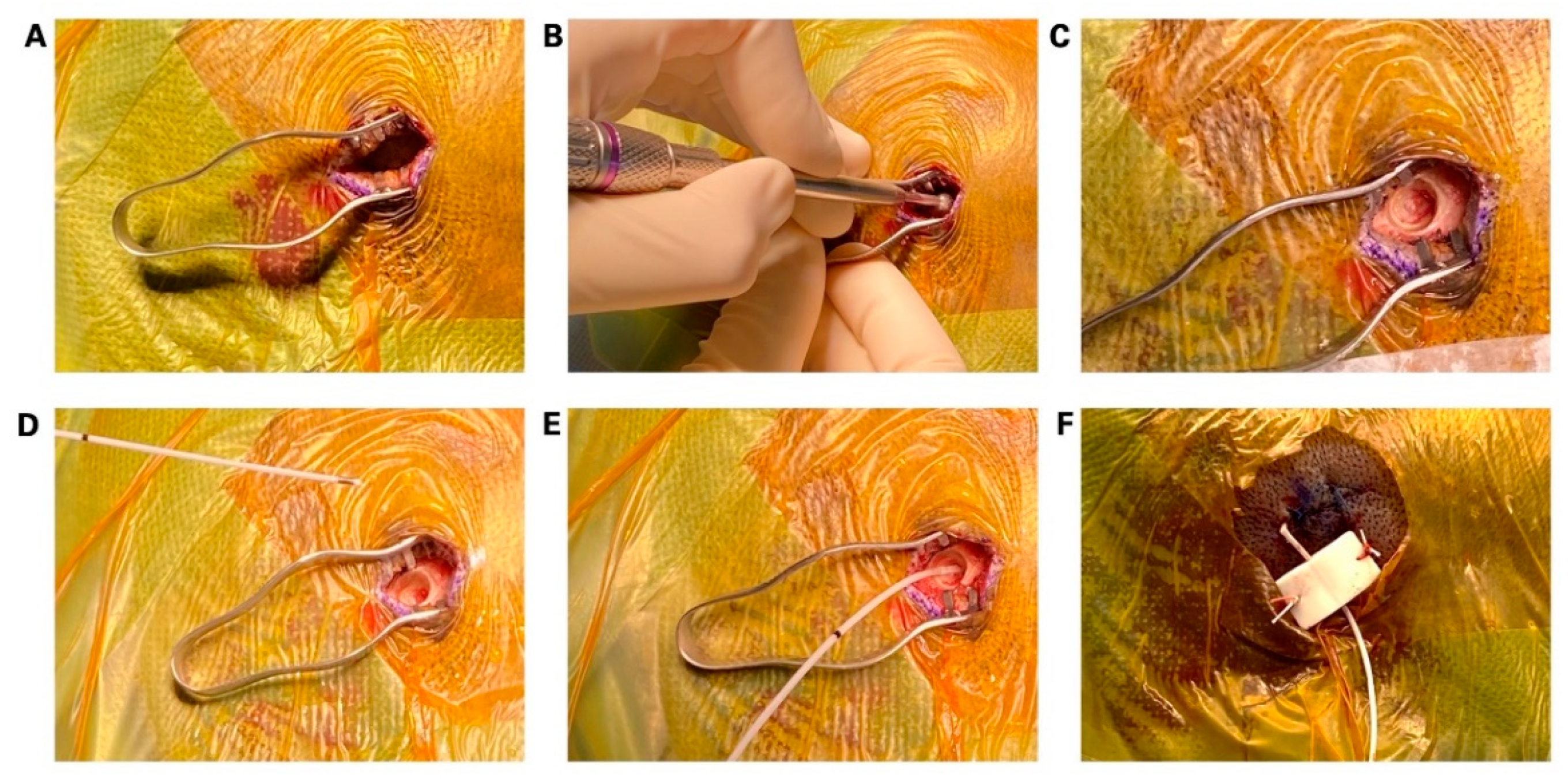 Micromachines 13 00397 g003 550
