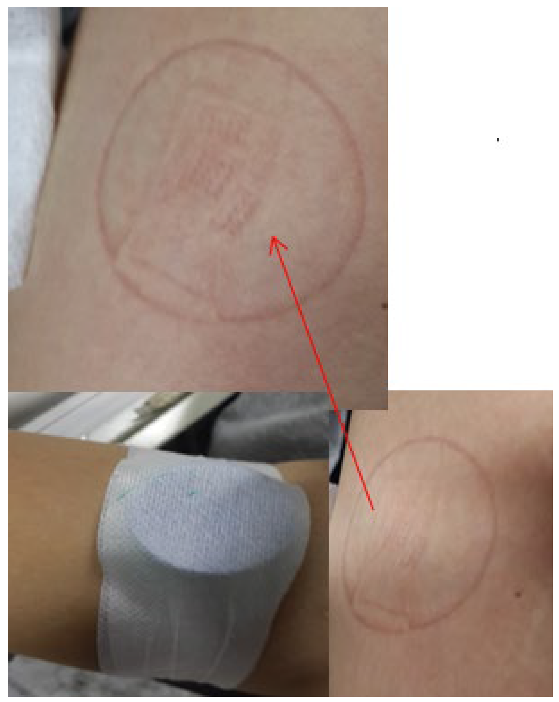 Micromachines 13 00478 g001 550