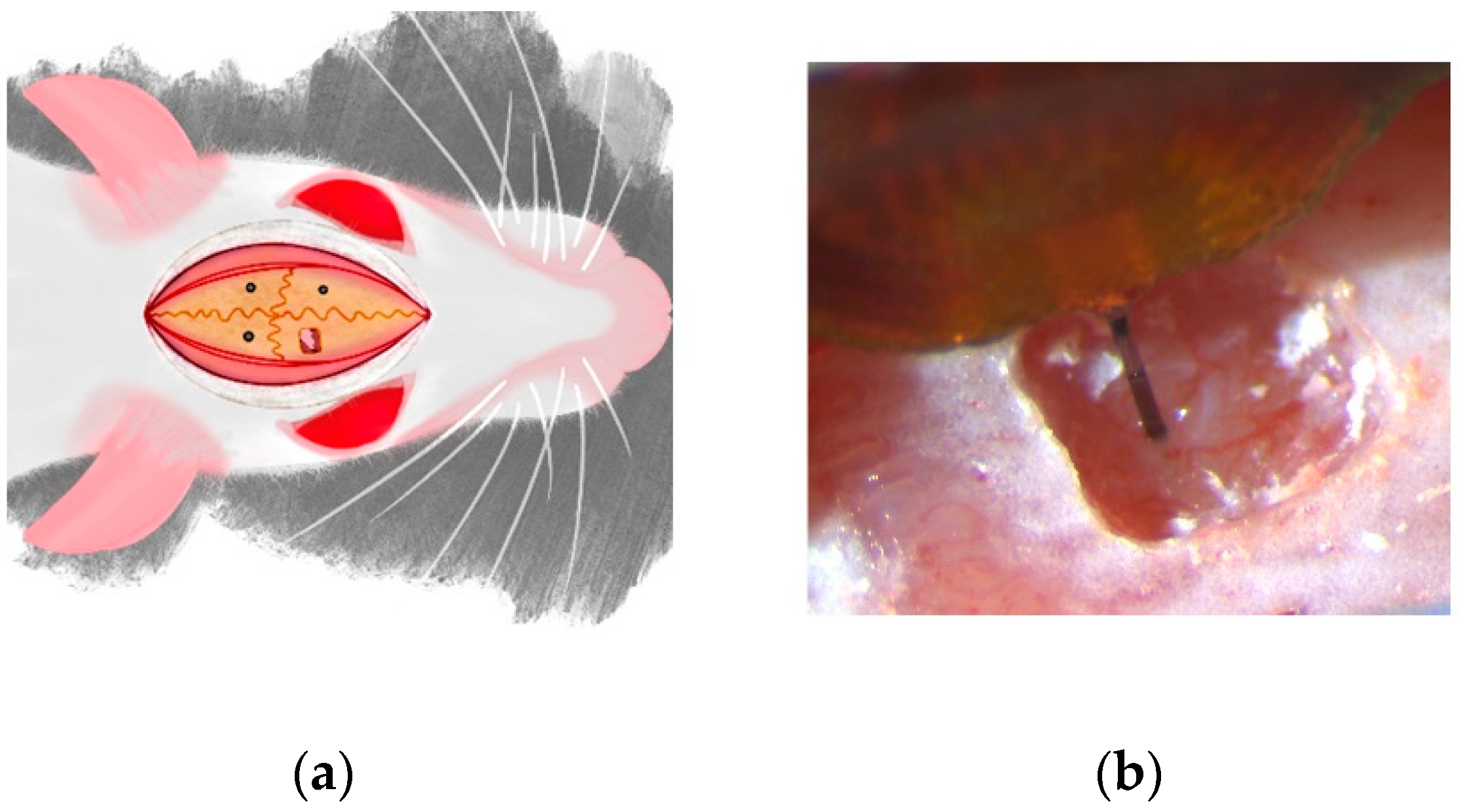 Micromachines 13 00480 g001