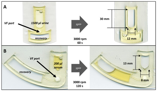 Characterization of a Centrifugal Microfluidic Orthogonal Flow Platform
