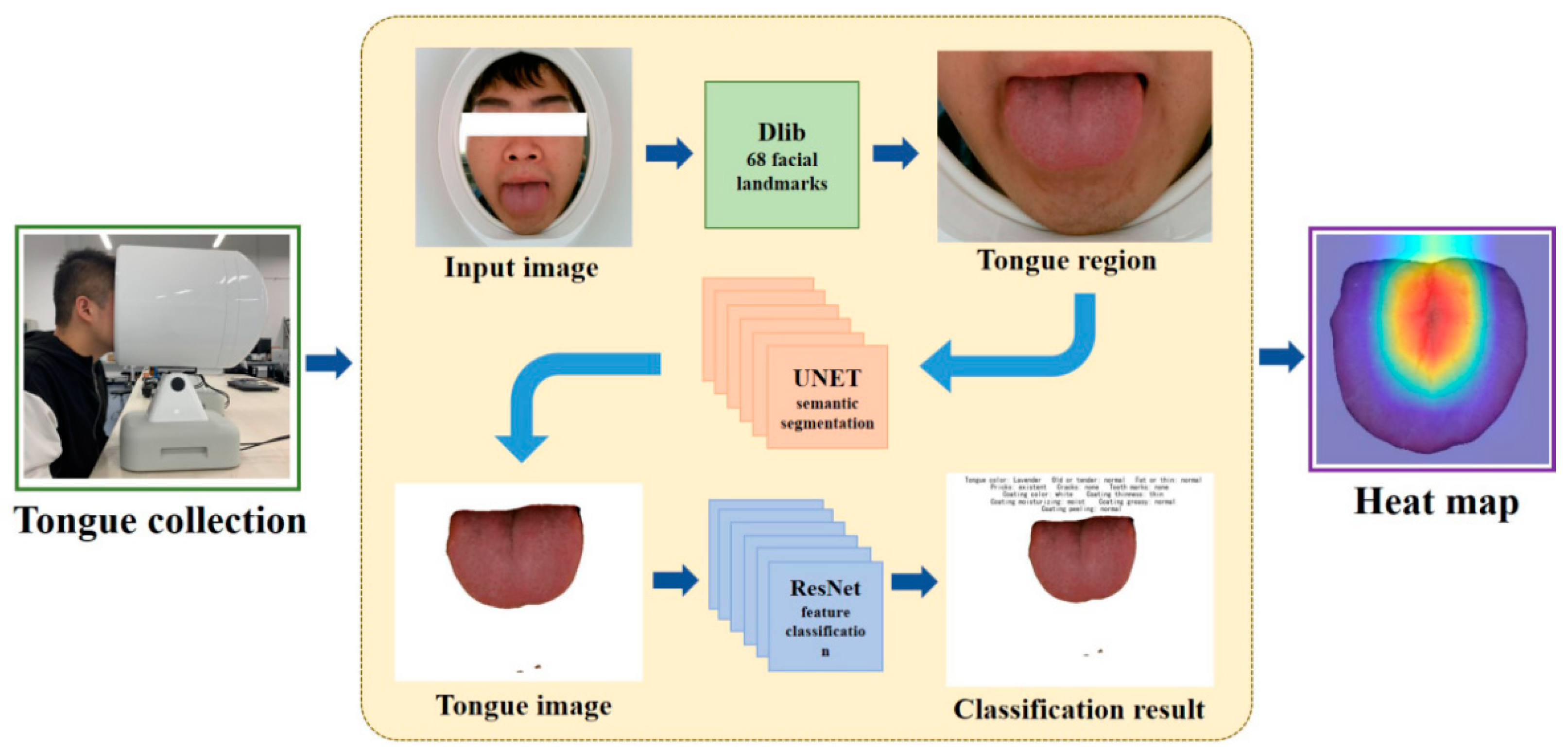 Micromachines 13 00501 g001 550