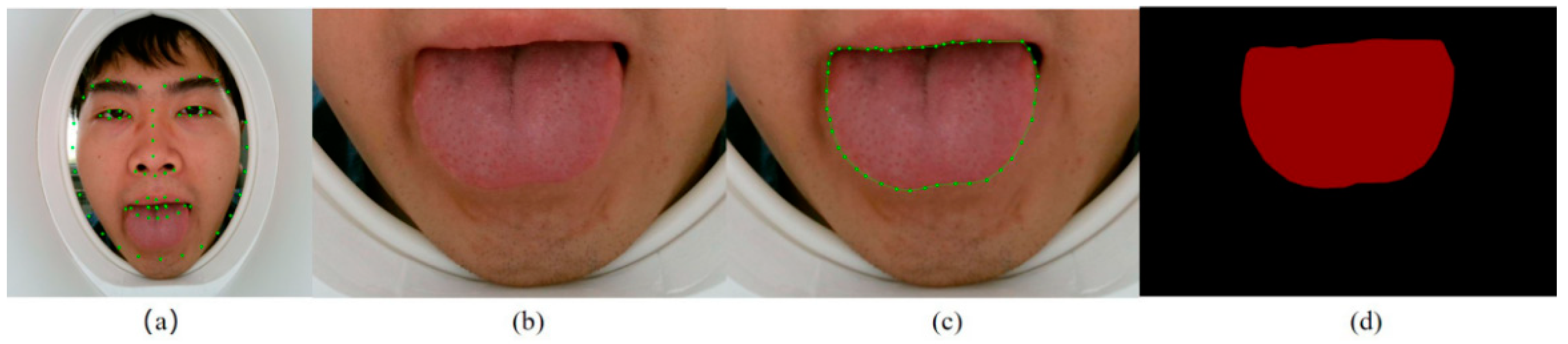 Micromachines 13 00501 g003 550