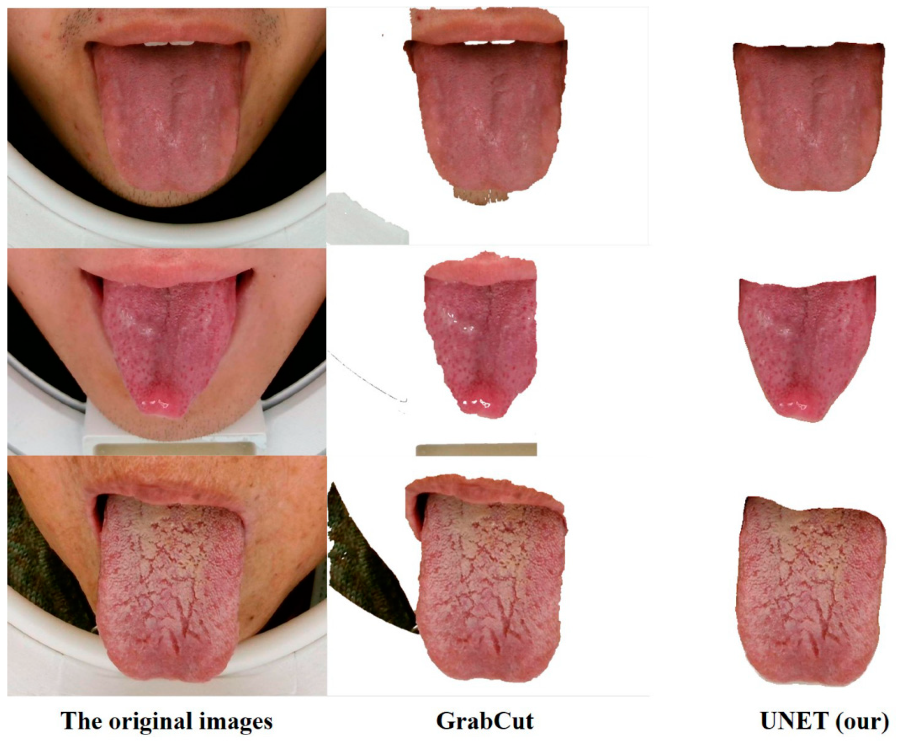 Micromachines 13 00501 g006 550