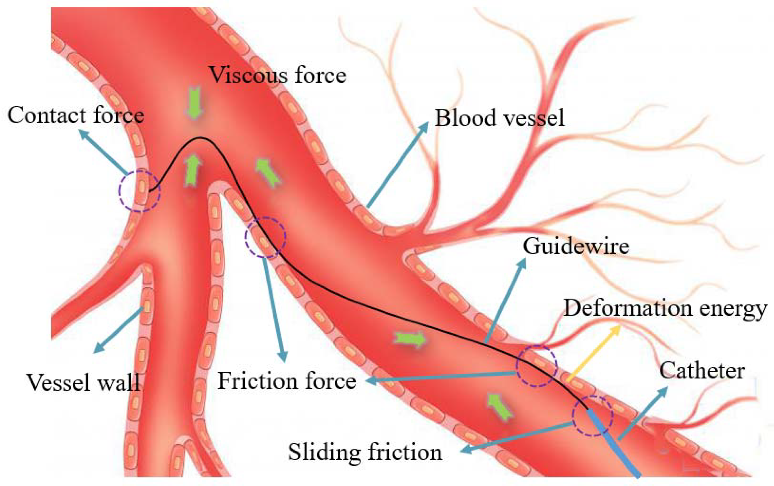 Micromachines 13 00505 g010 550