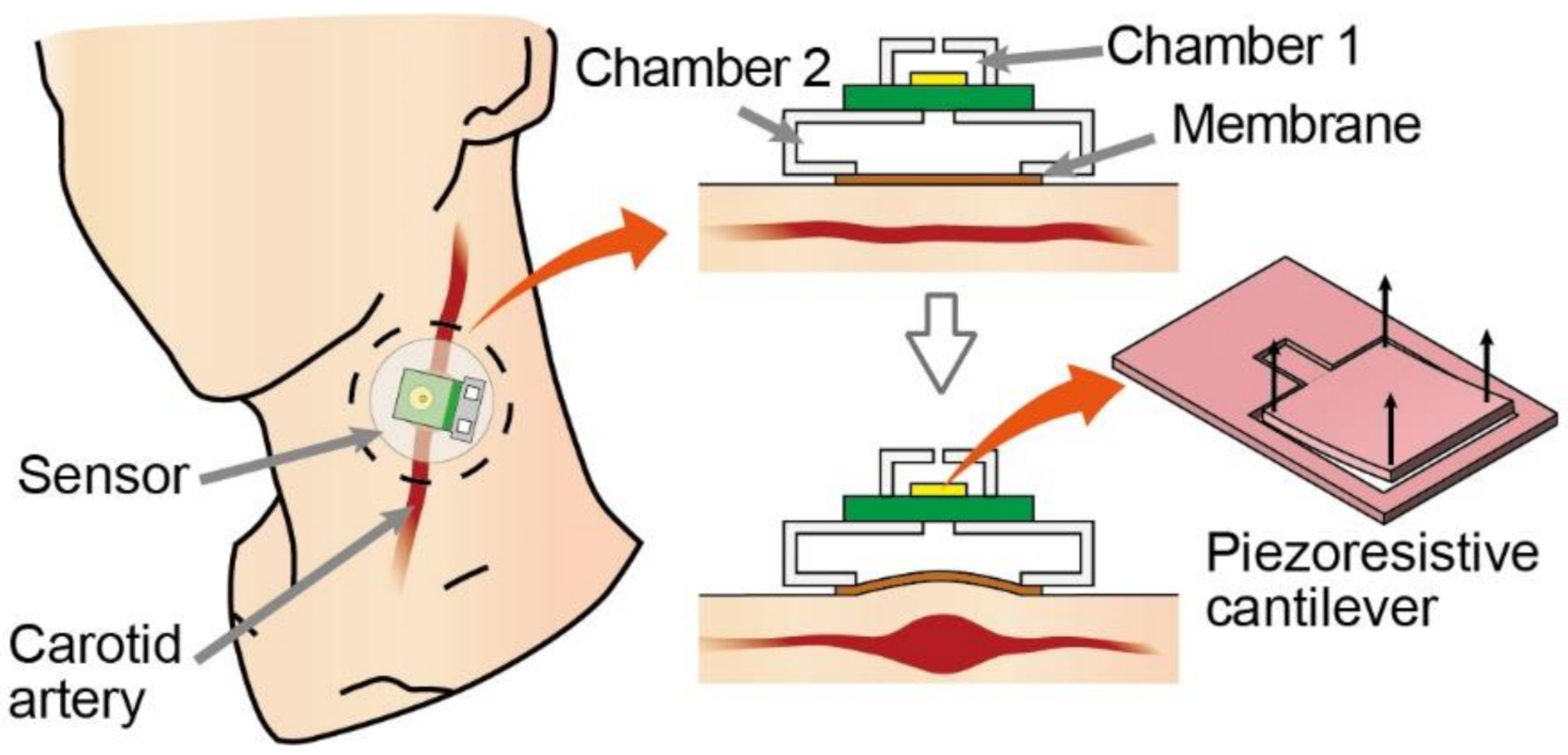 Micromachines 13 00645 g001