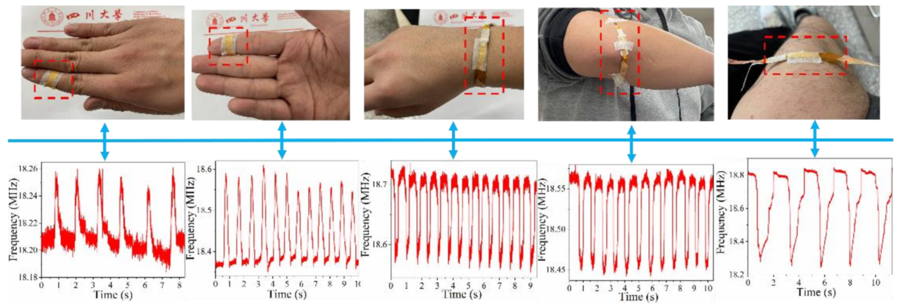 Micromachines 13 00694 g012