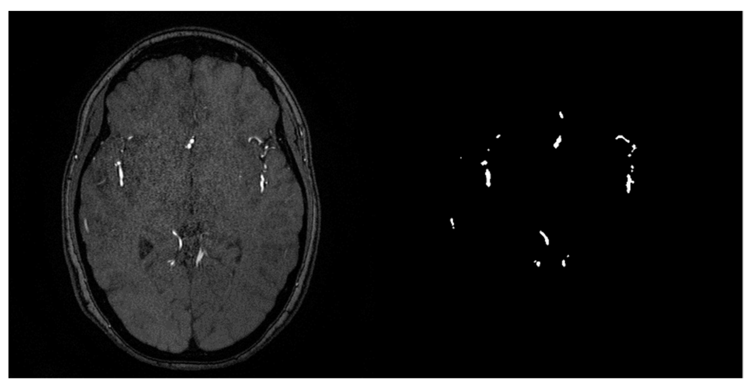 Micromachines 13 00823 g001