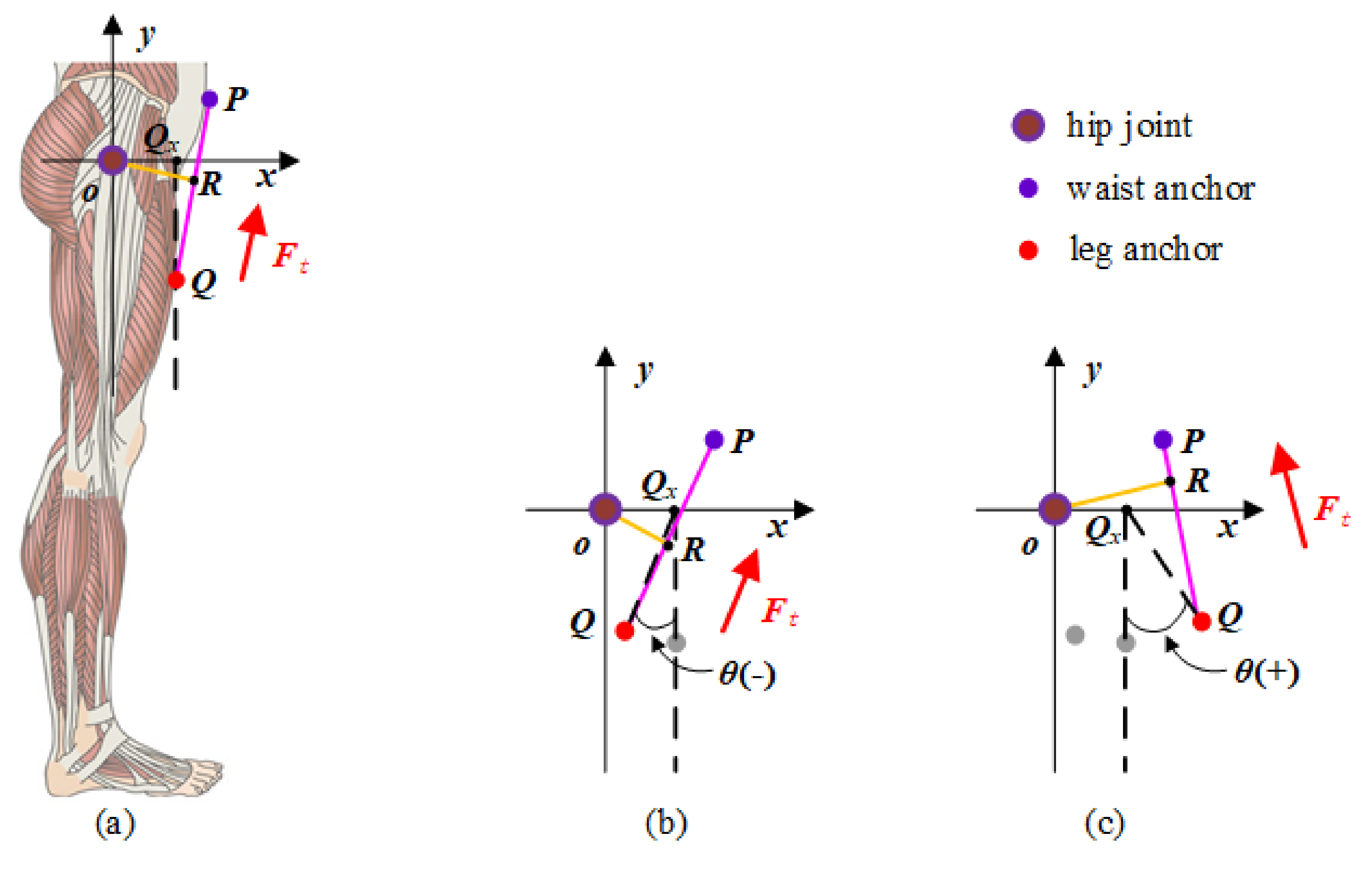 Micromachines 13 00825 g0a1