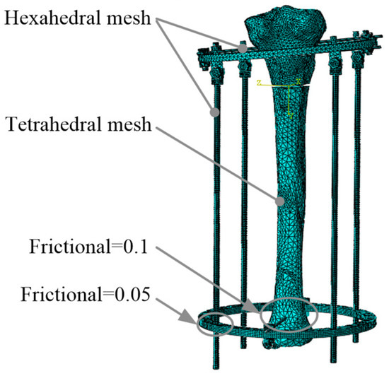 Screw Analysis, Modeling and Experiment on the Mechanics of Tibia ...