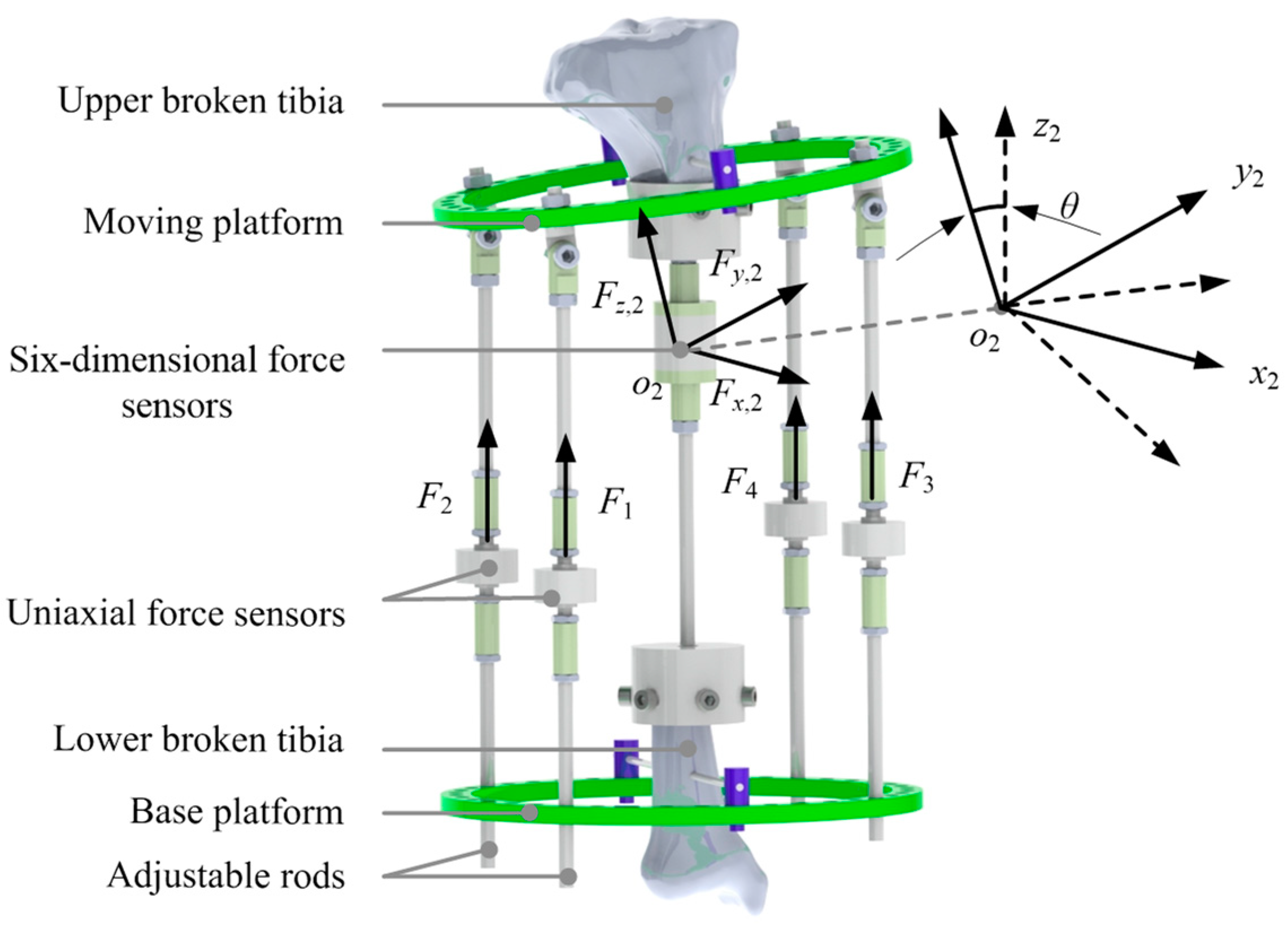 Micromachines 13 00932 g004 550