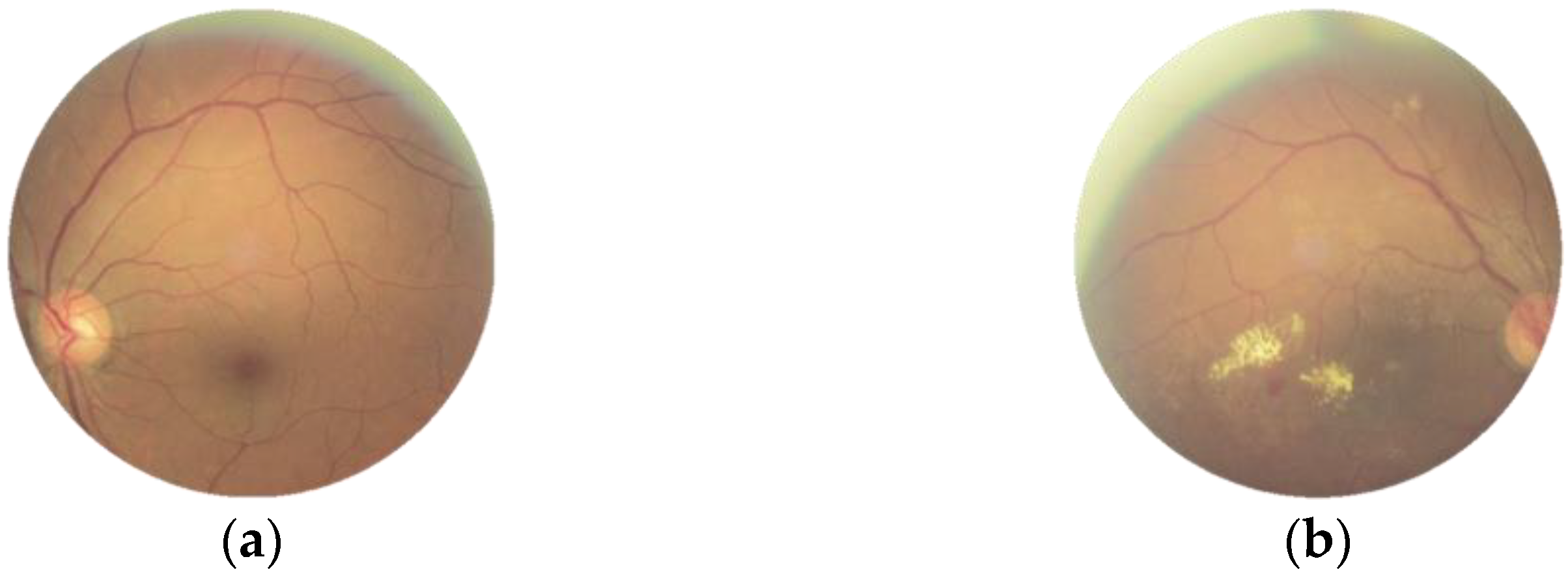 Micromachines 13 00947 g001 550