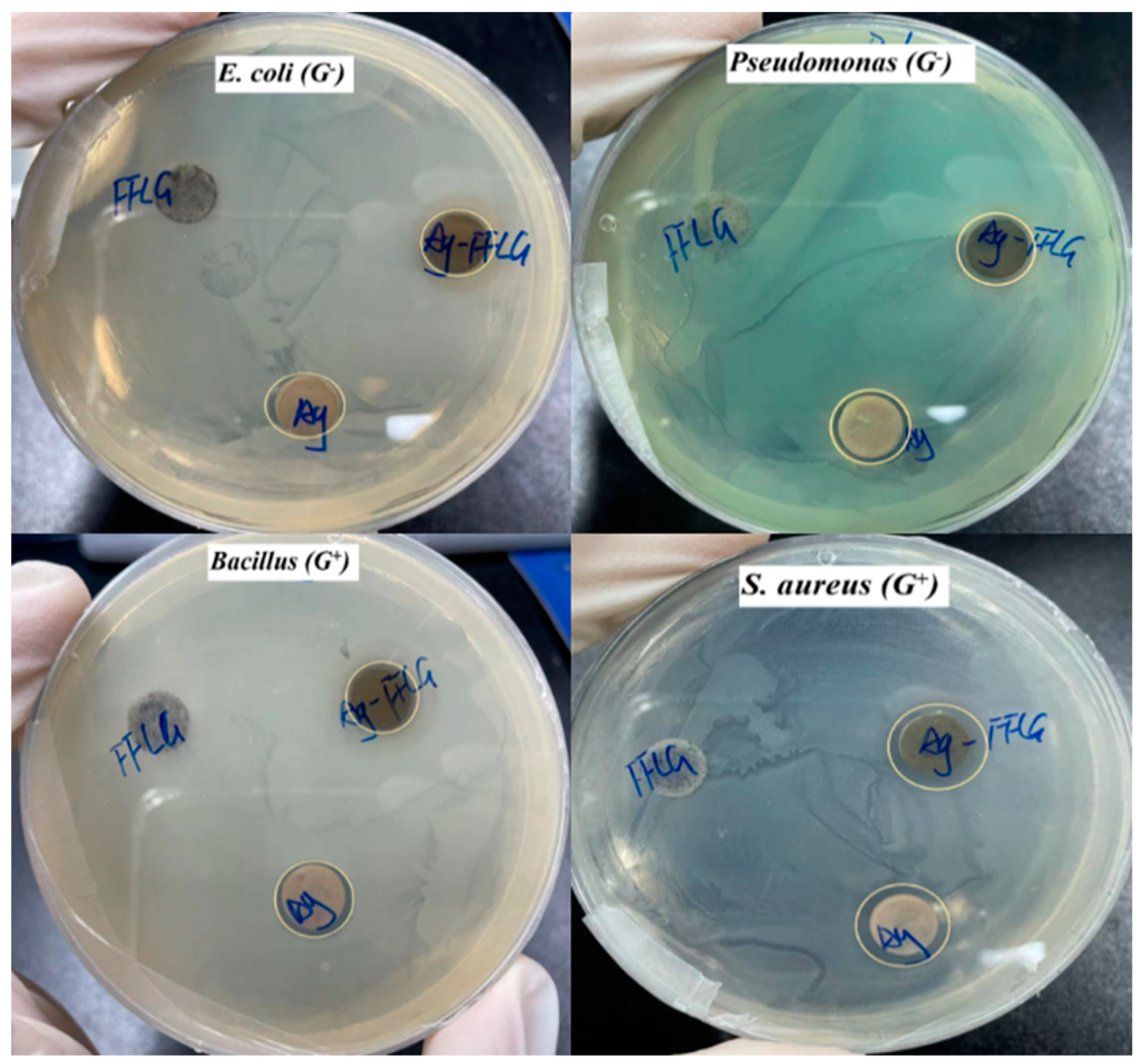 Micromachines 13 01232 g010
