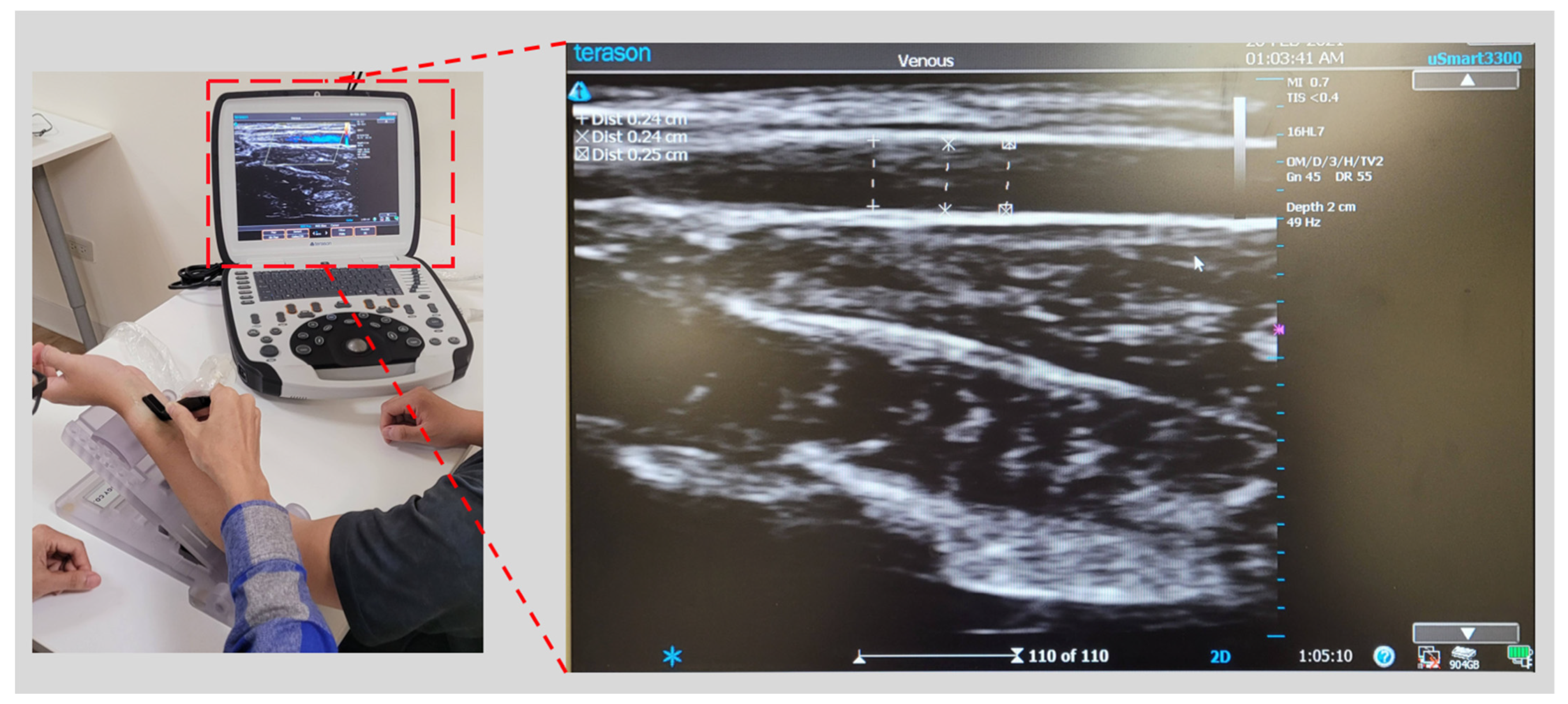 Micromachines 13 01327 g007