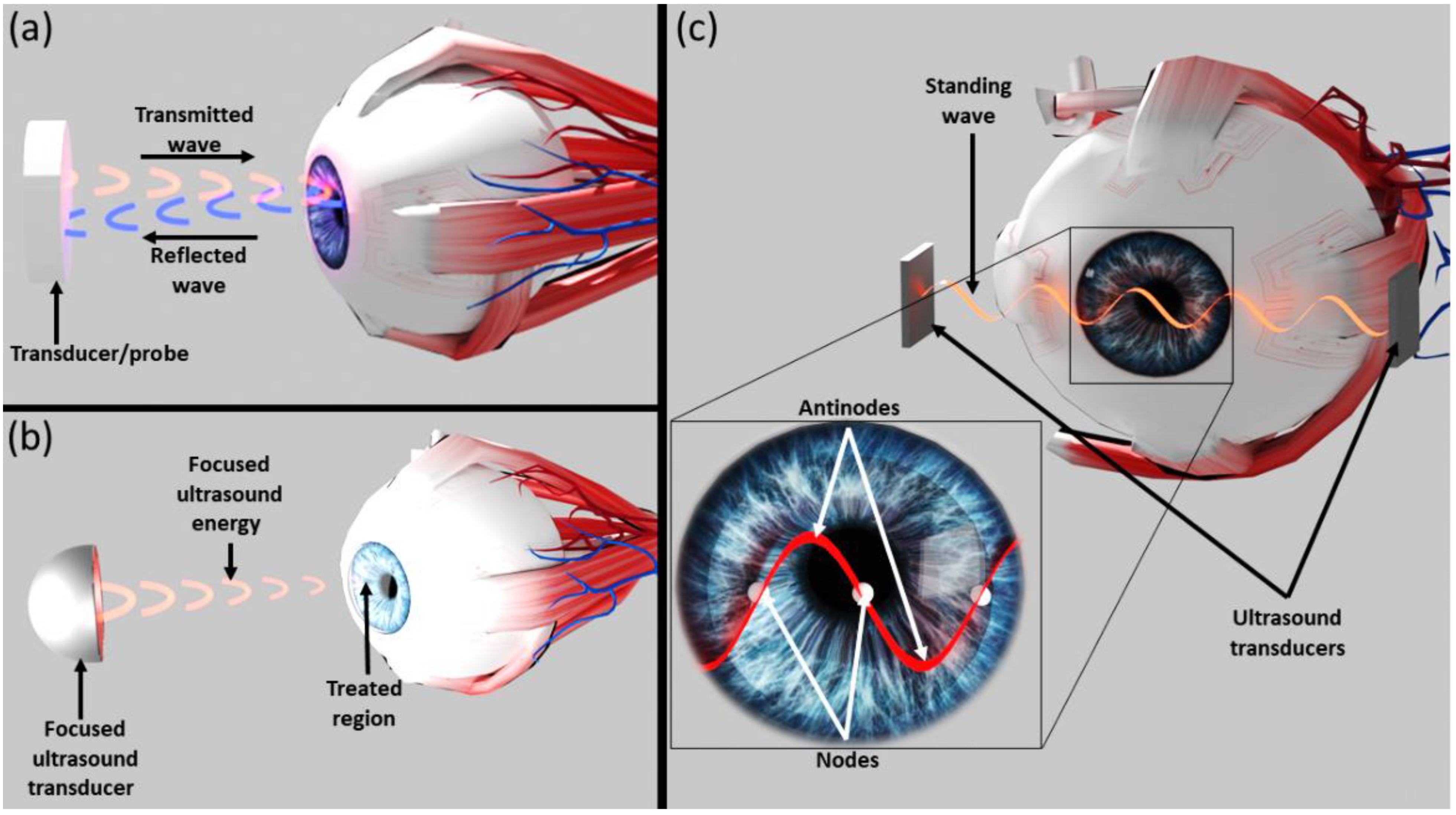 Micromachines 13 01362 g001 550