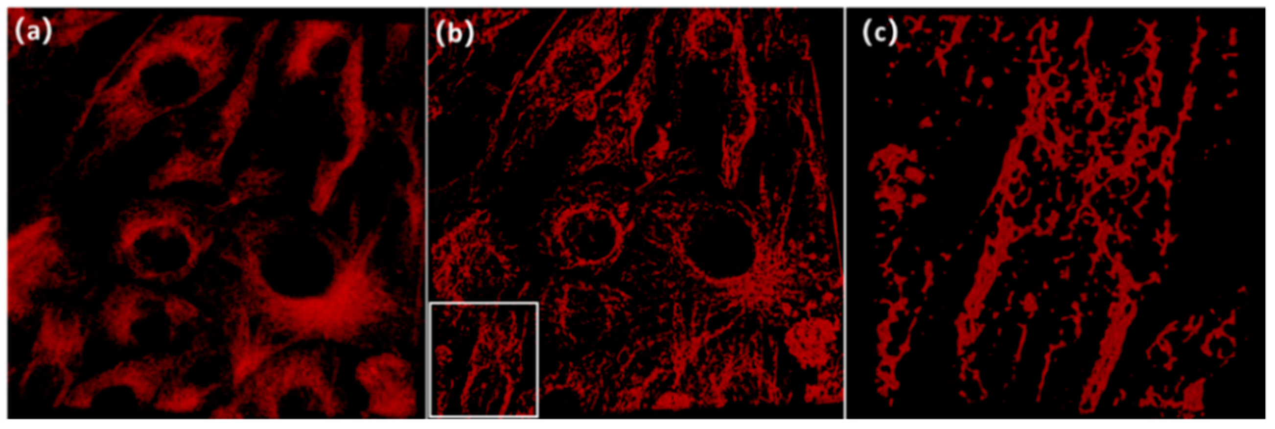 Micromachines 13 01515 g011