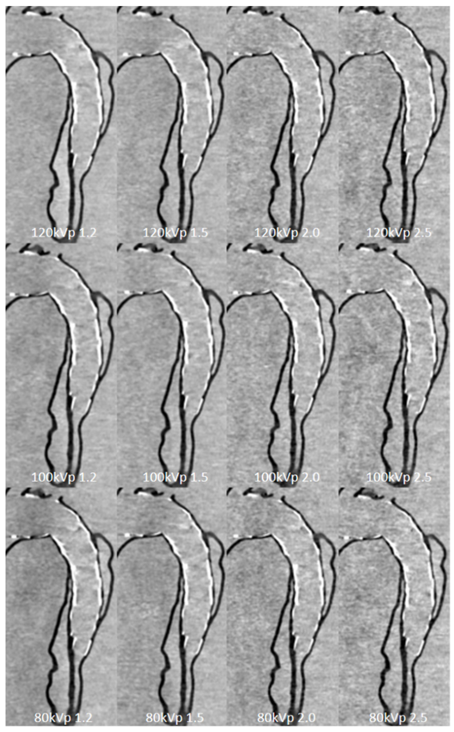 Micromachines 13 01575 g014