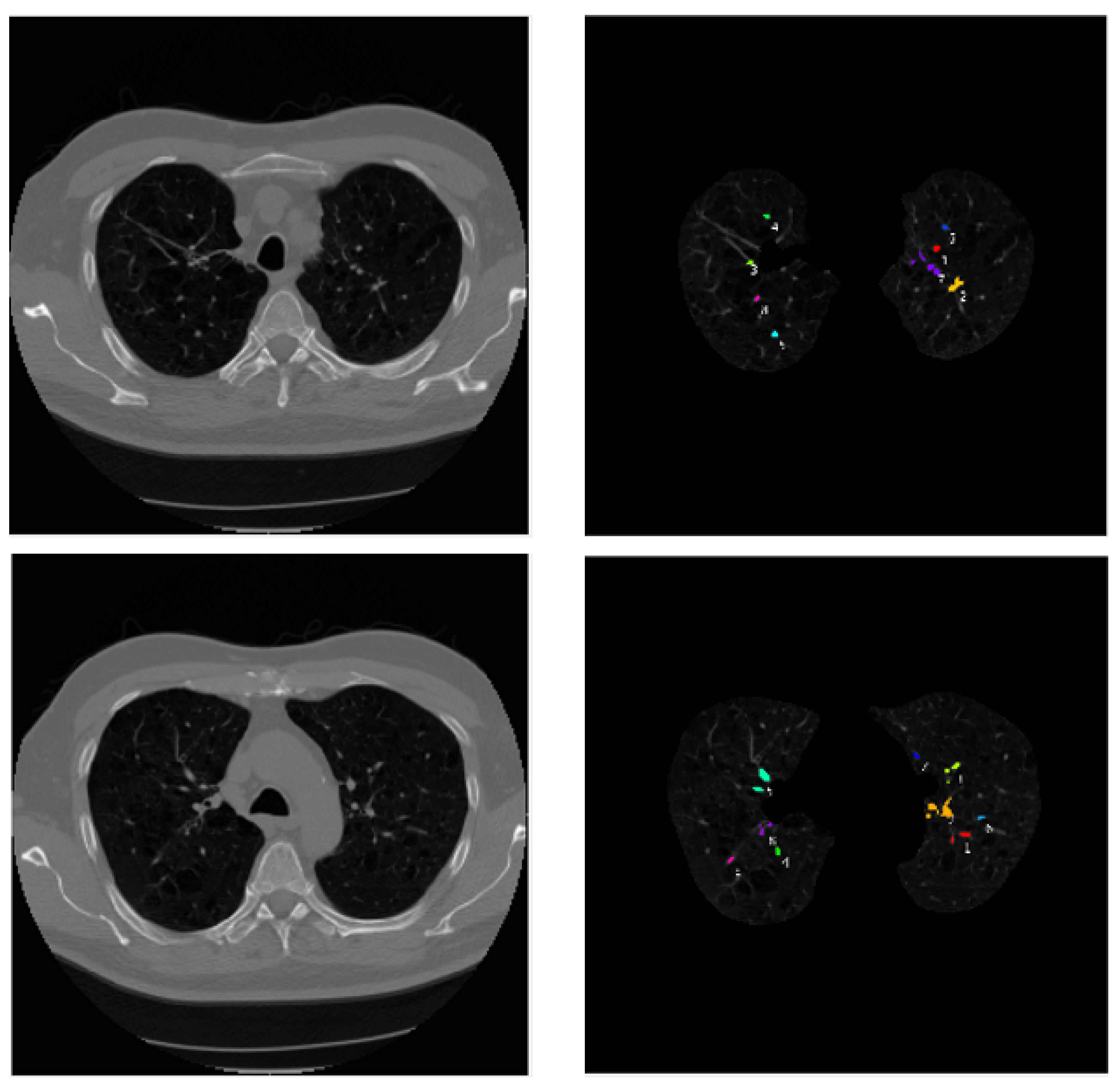 Micromachines 13 01765 g007b Micromachines 13 01765 g007b