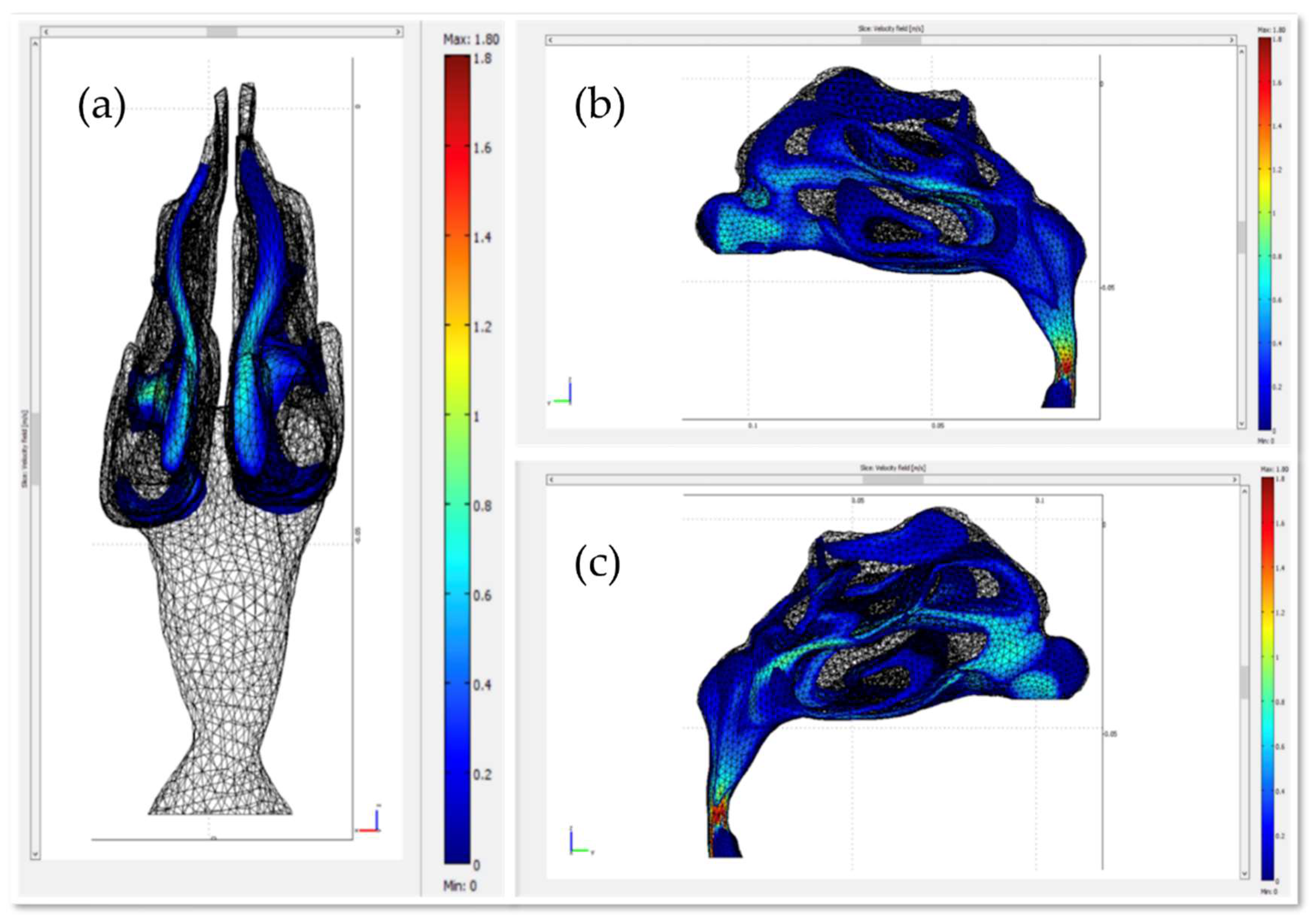 Micromachines | Free Full-Text | Computational Study of Magnetic 