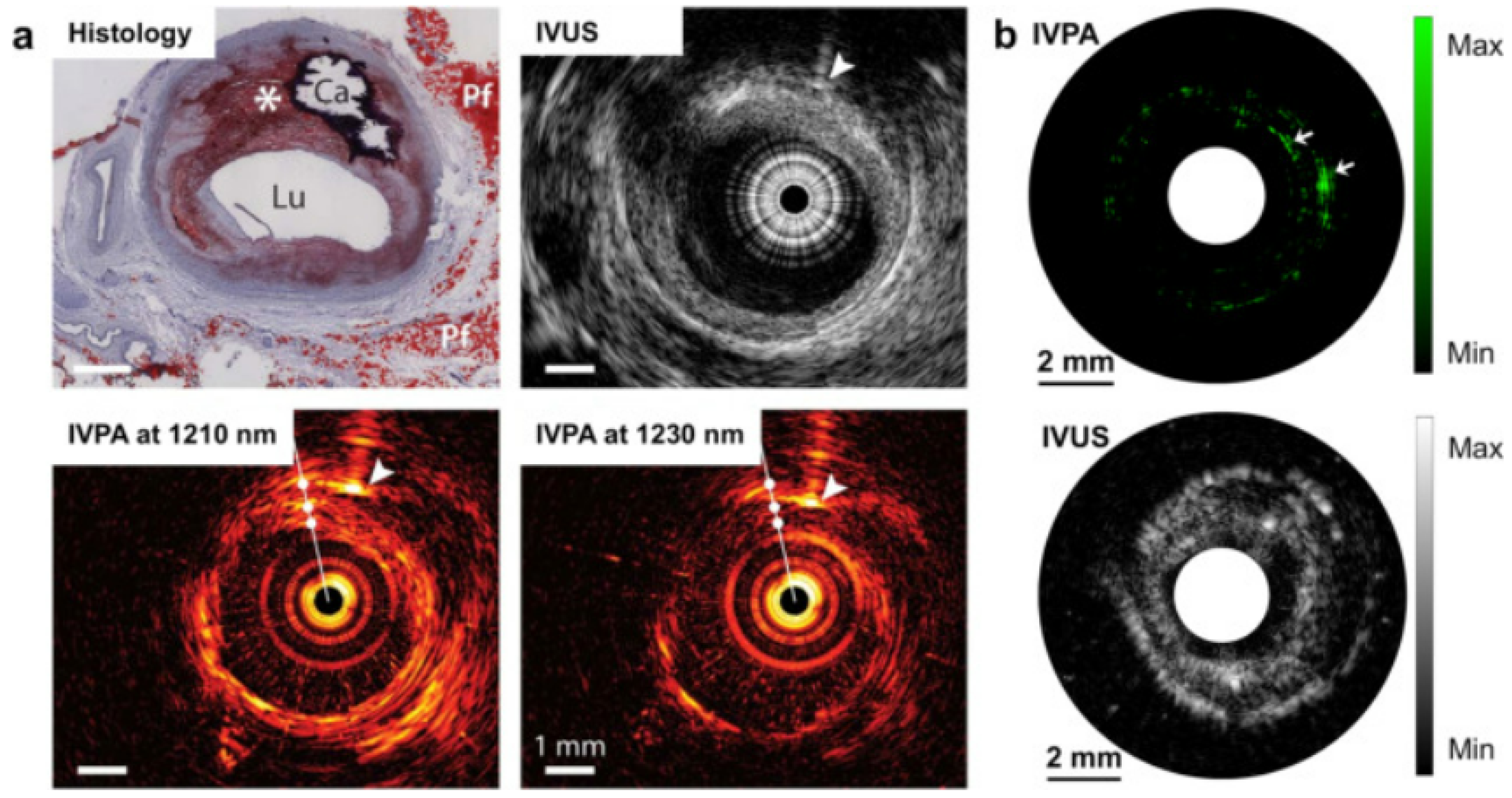 Micromachines 13 01900 g006 Micromachines 13 01900 g006