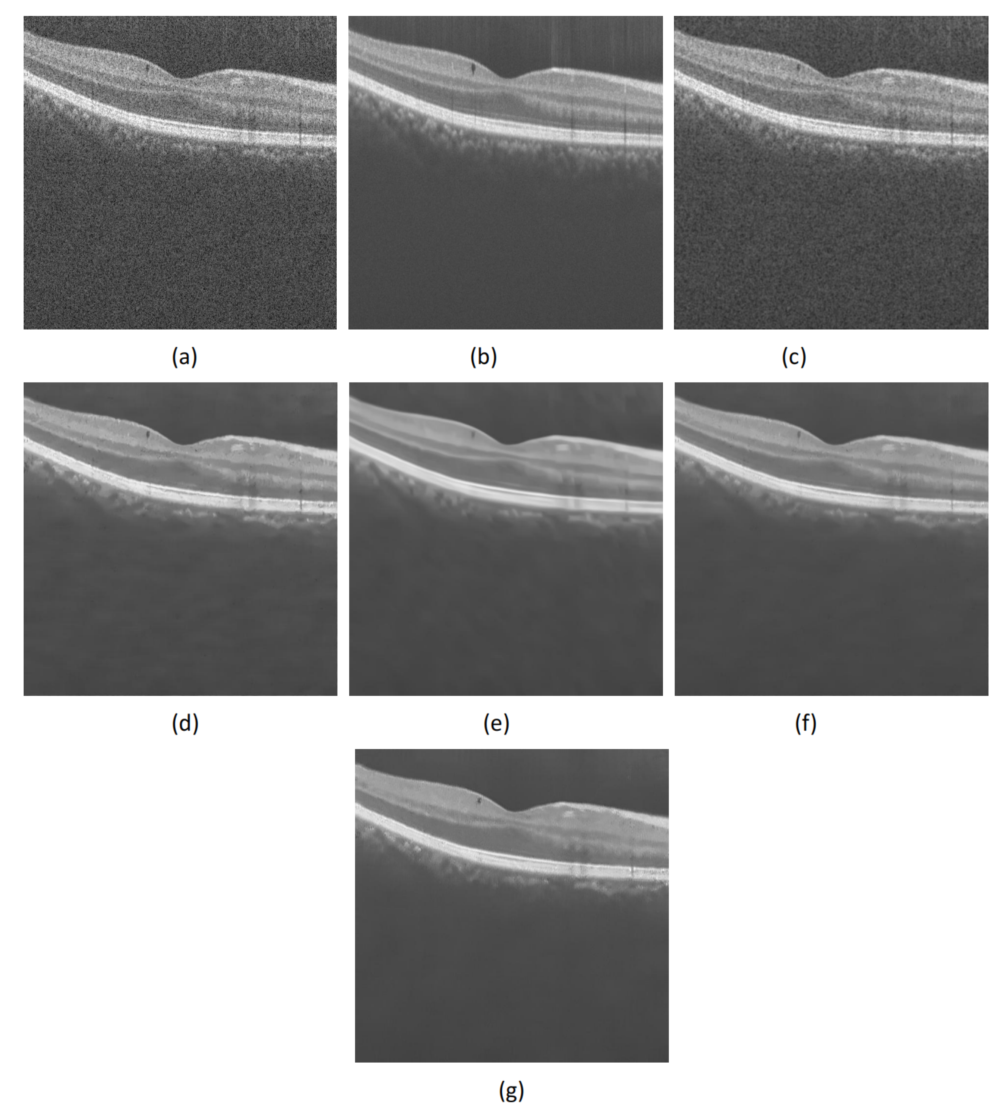 Micromachines 13 02039 g003 Micromachines 13 02039 g003