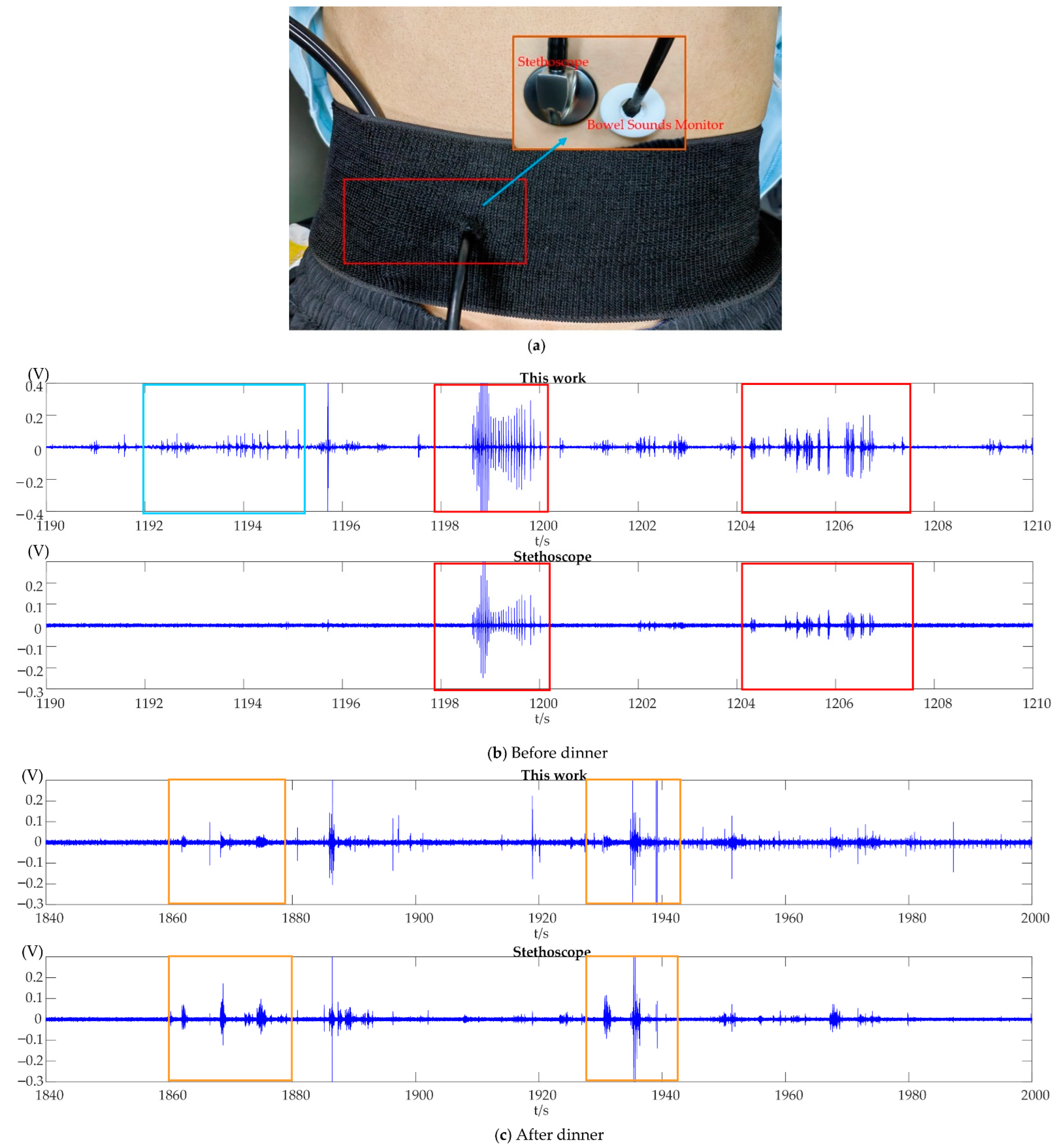 Micromachines 13 02221 g009