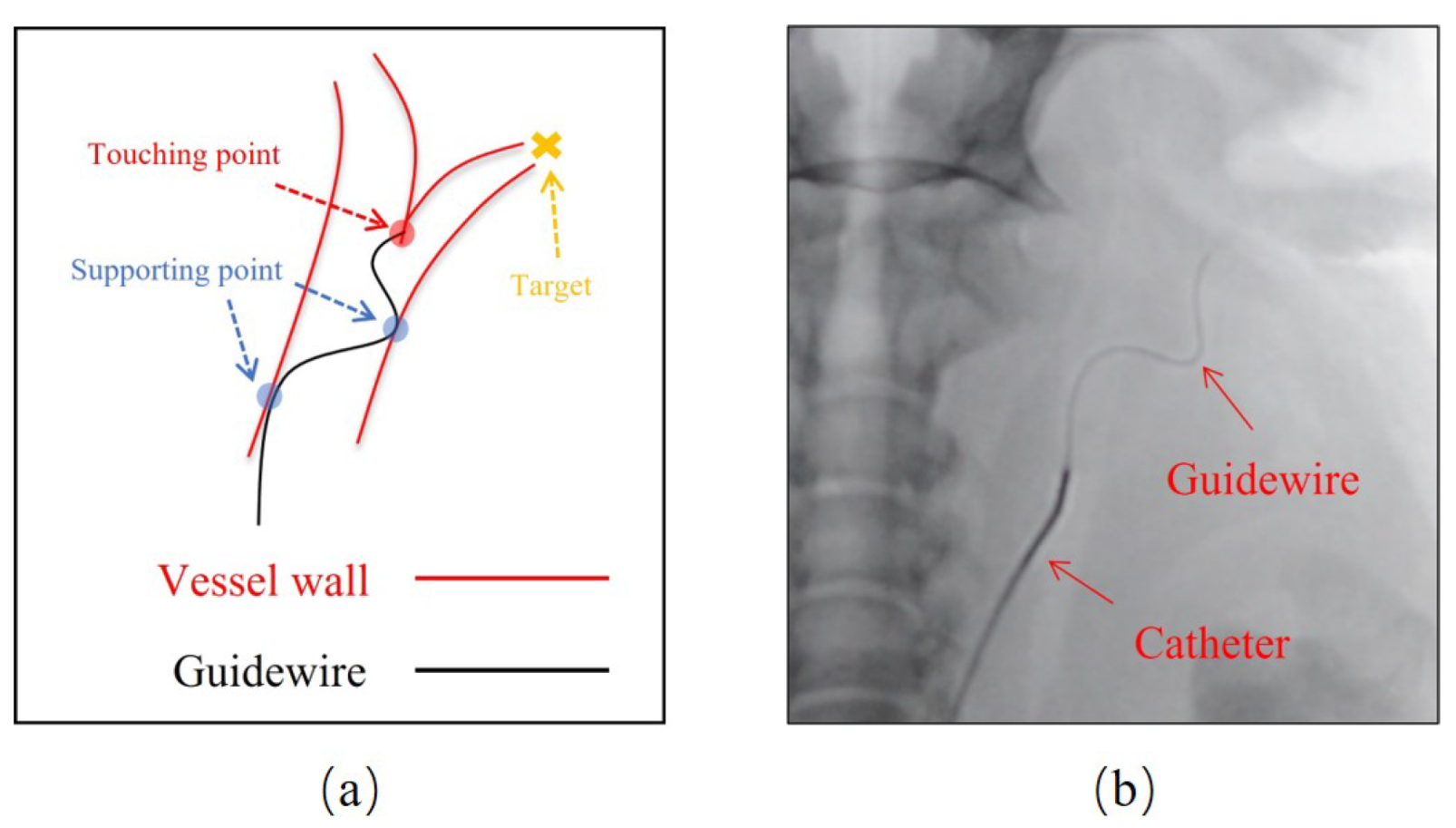 Micromachines Free FullText A DeepLearningBased Guidewire Compliant Control Method for