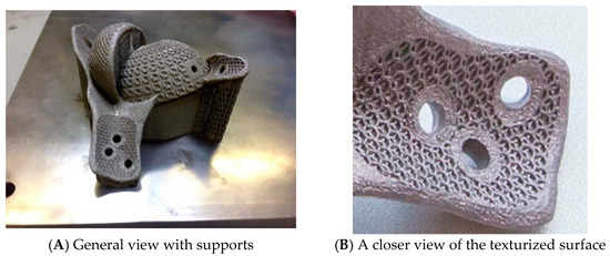 A Review of Research Progress in Selective Laser Melting (SLM)