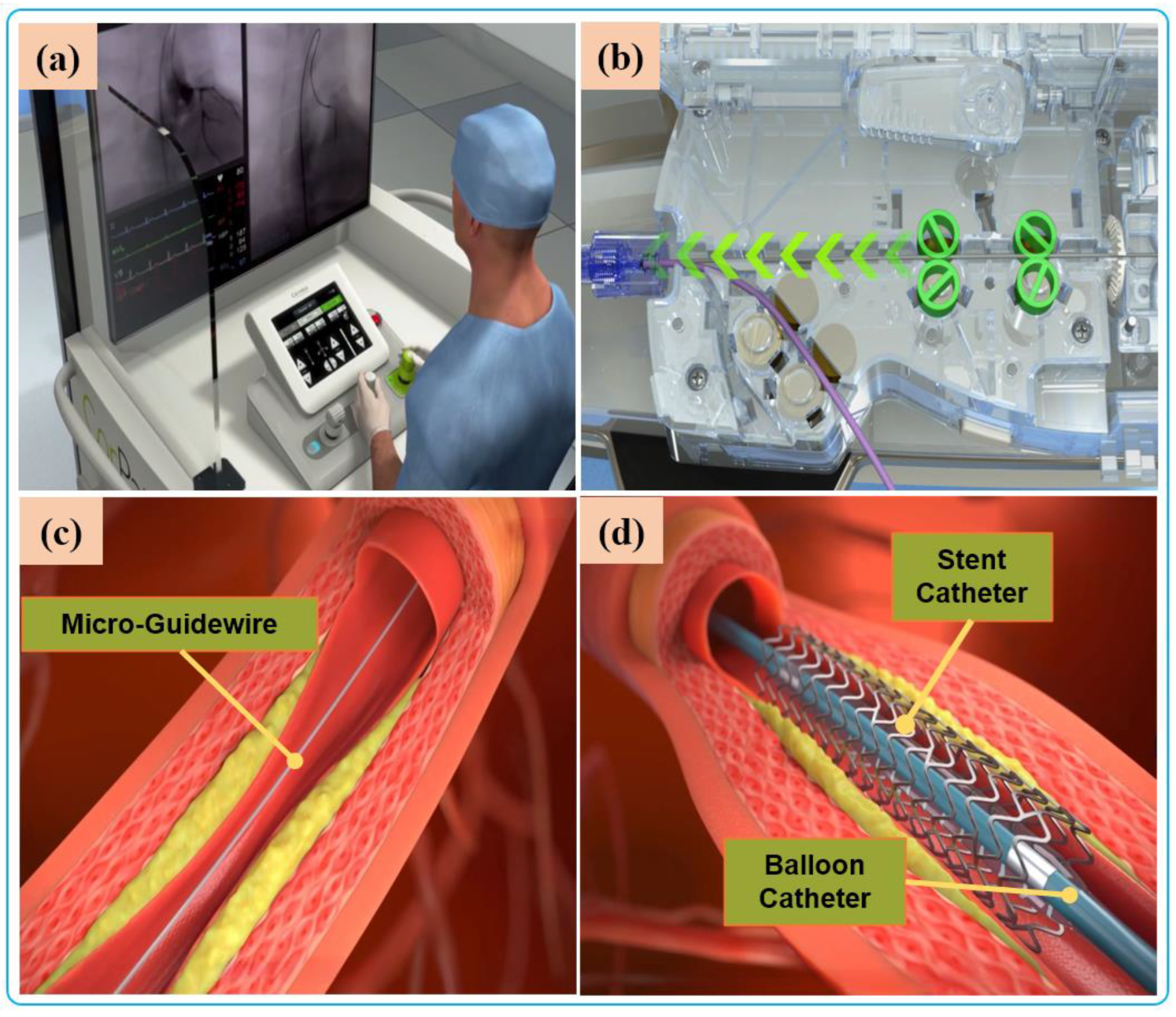 Micromachines 14 00197 g005 Micromachines 14 00197 g005