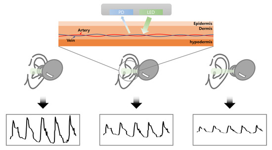 Photoplethysmography-Based Distance Estimation for True