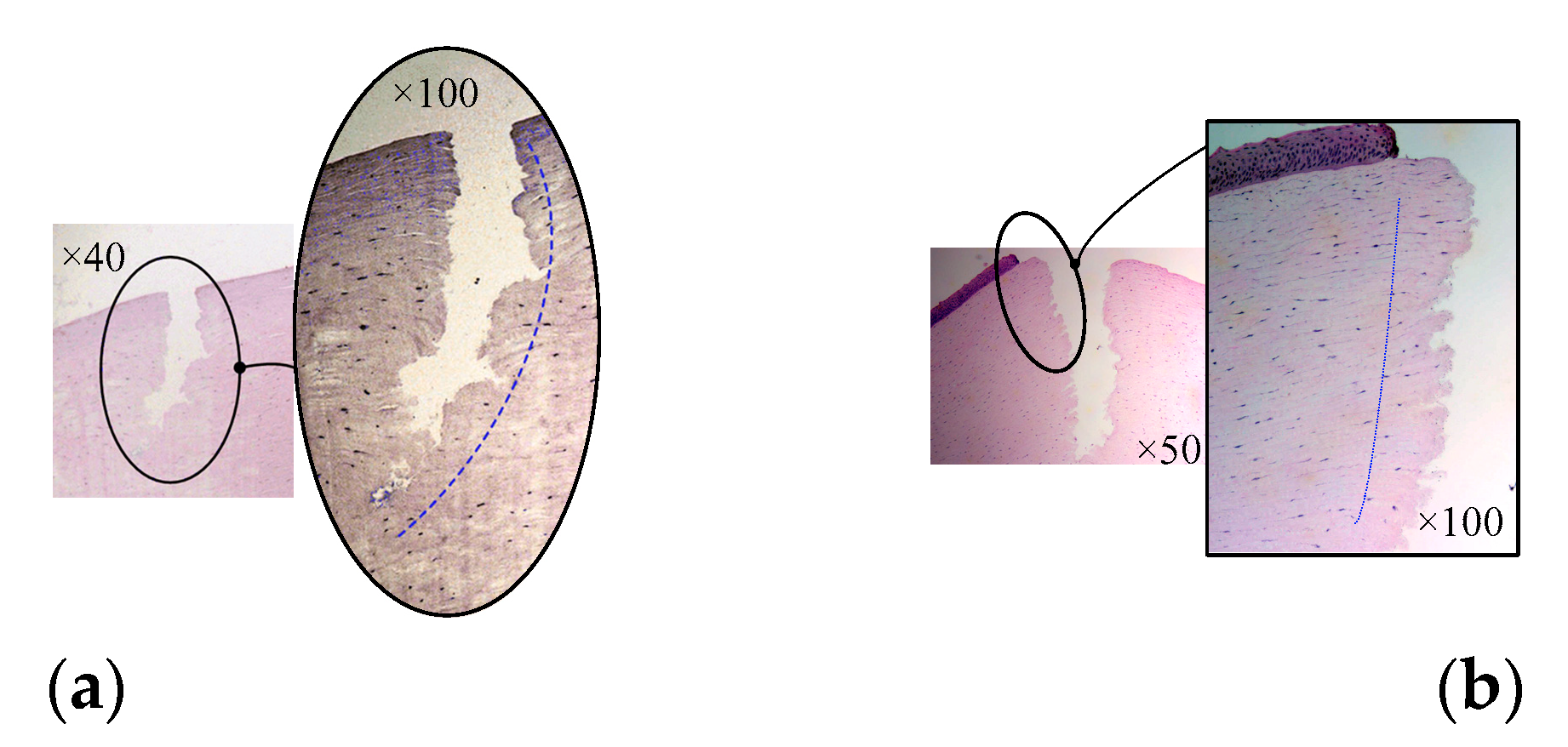 Micromachines 14 00438 g017 Micromachines 14 00438 g017