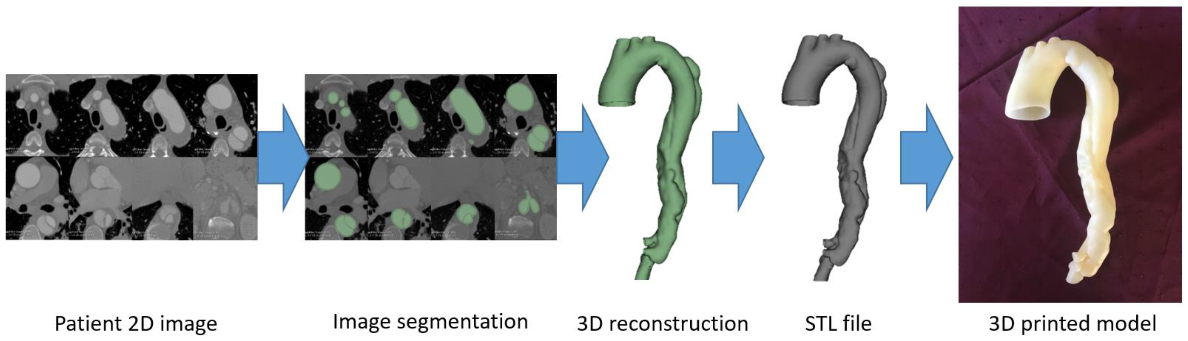 Micromachines 14 00464 g003 Micromachines 14 00464 g003