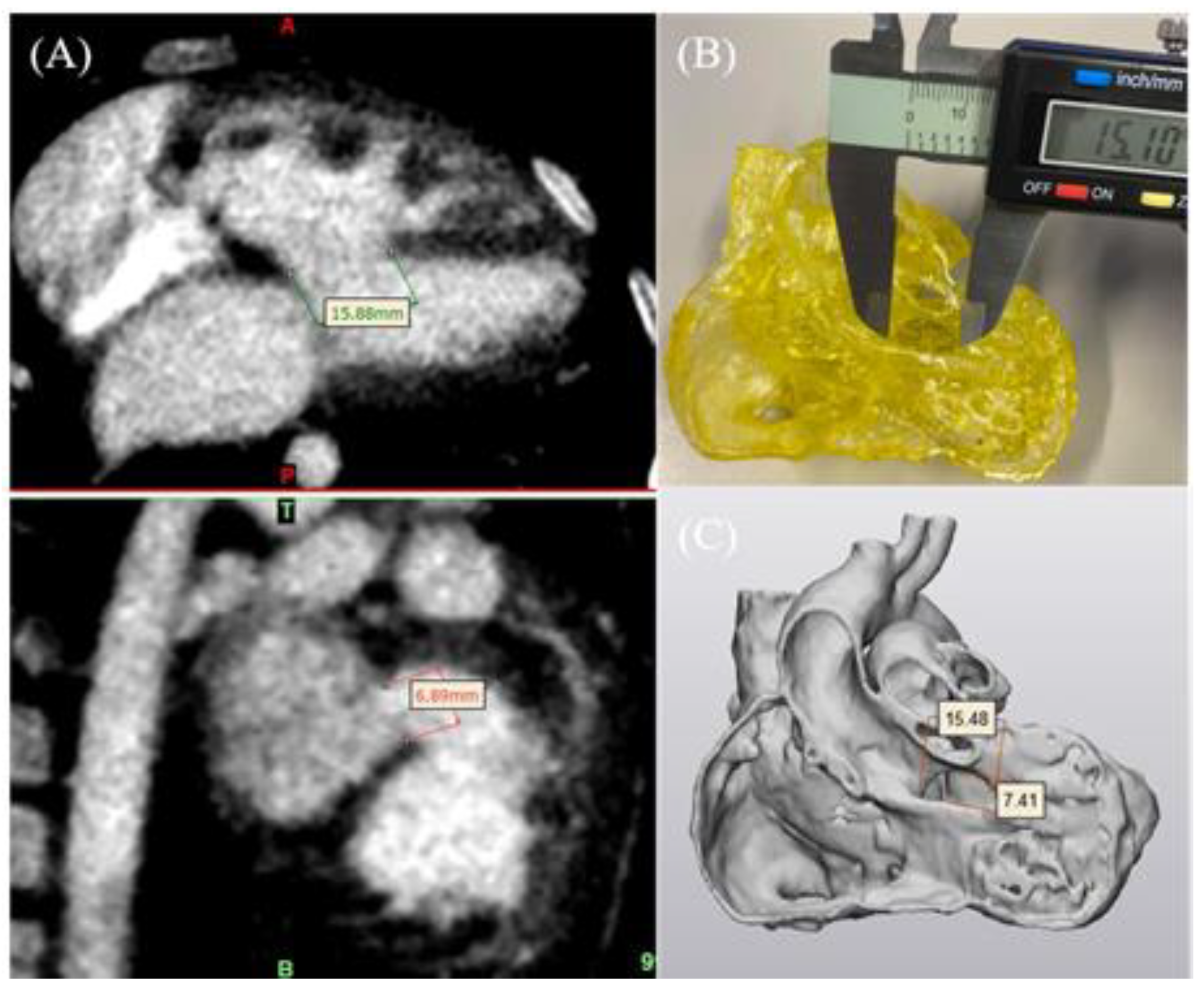 Micromachines 14 00464 g004 Micromachines 14 00464 g004