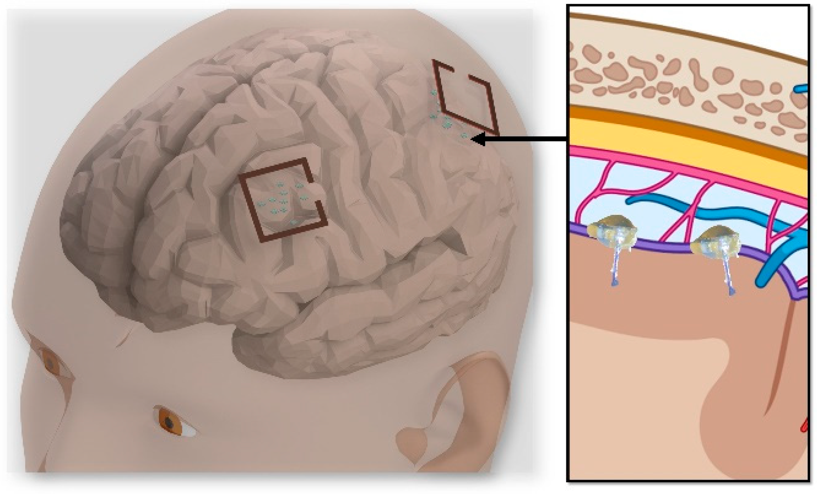 Micromachines 14 00476 g001 Micromachines 14 00476 g001