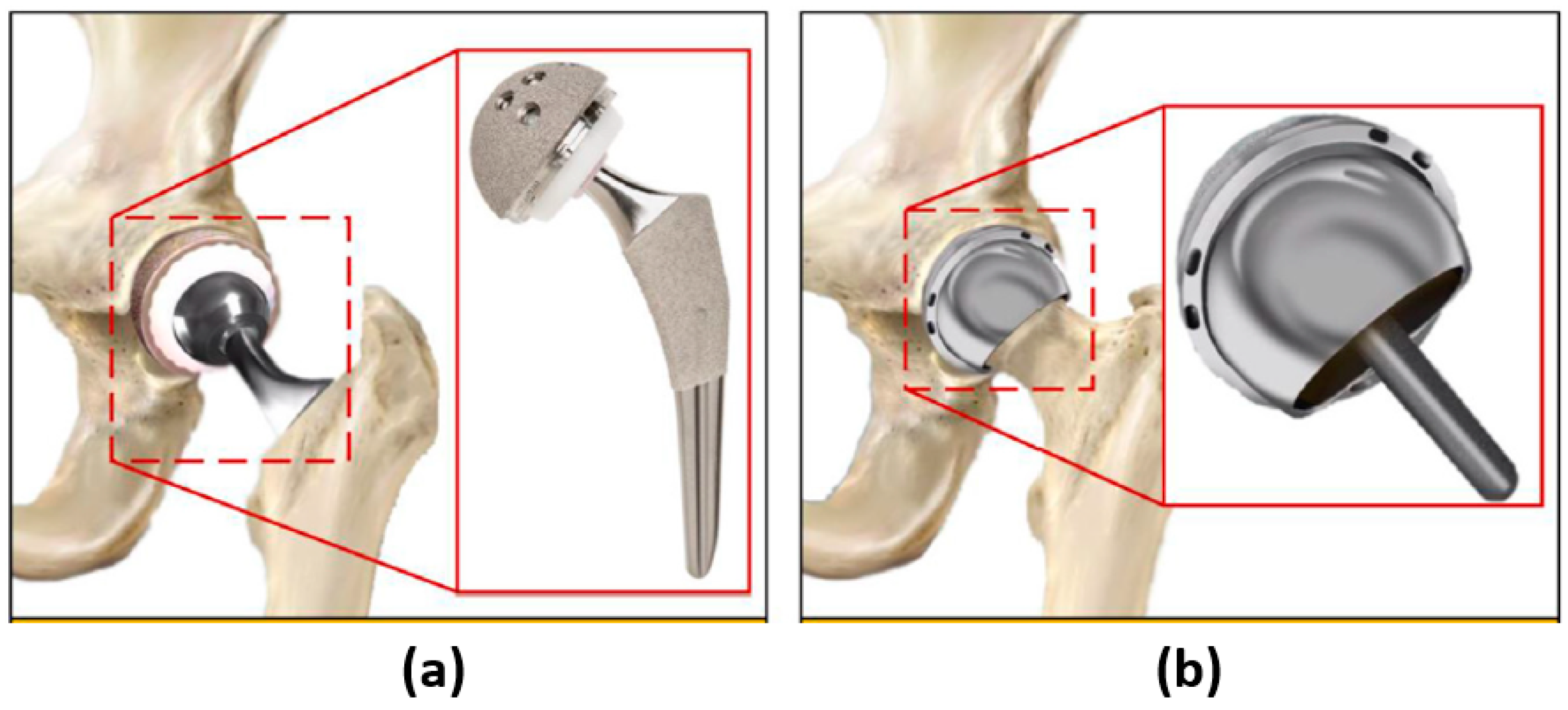 Micromachines 14 00523 g001 Micromachines 14 00523 g001