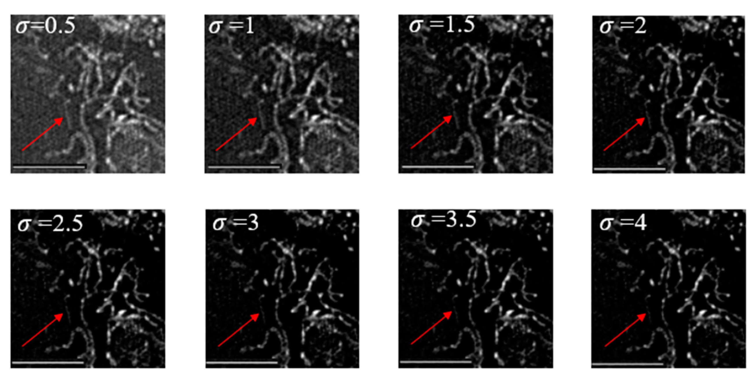 Micromachines 14 00642 g009