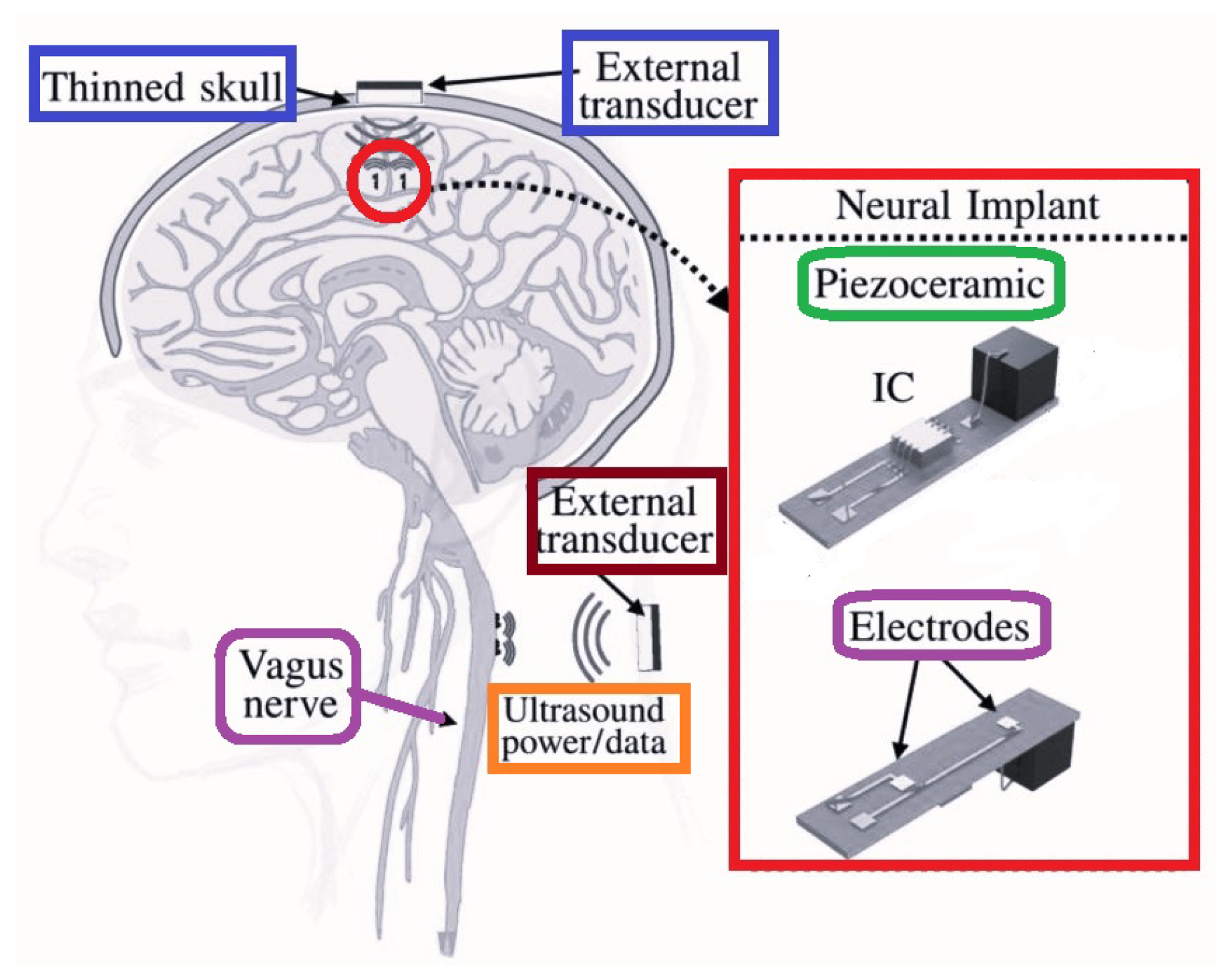Micromachines 14 00786 g029 Micromachines 14 00786 g029