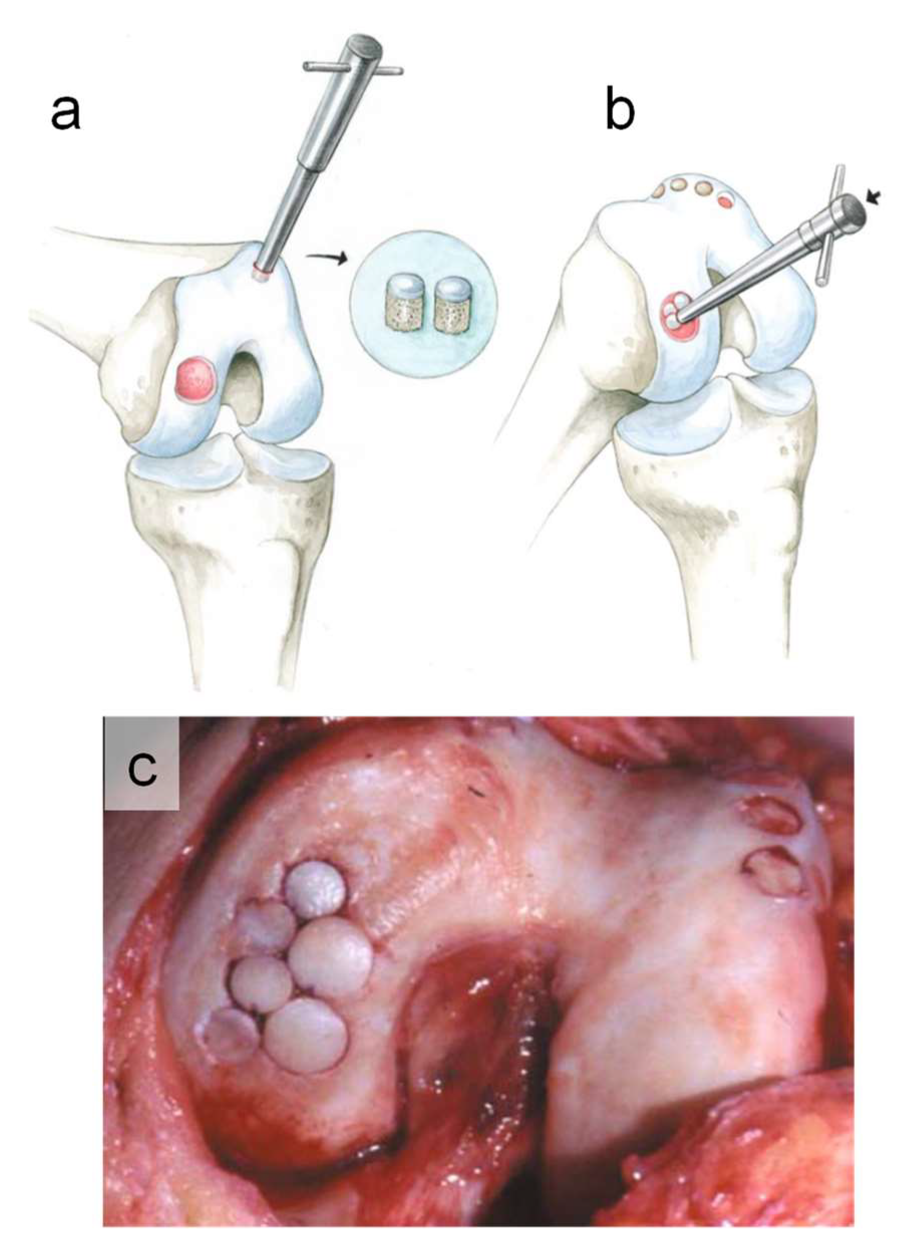 Micromachines 14 00856 g001 Micromachines 14 00856 g001
