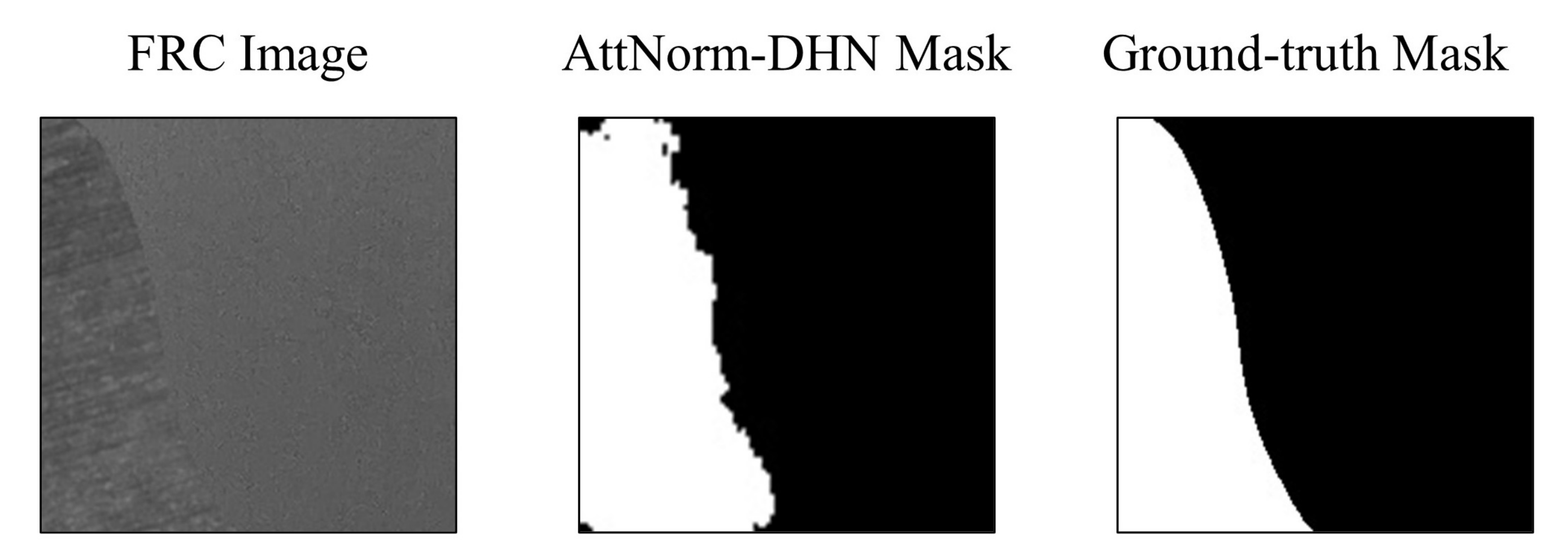 Micromachines 14 00879 g009