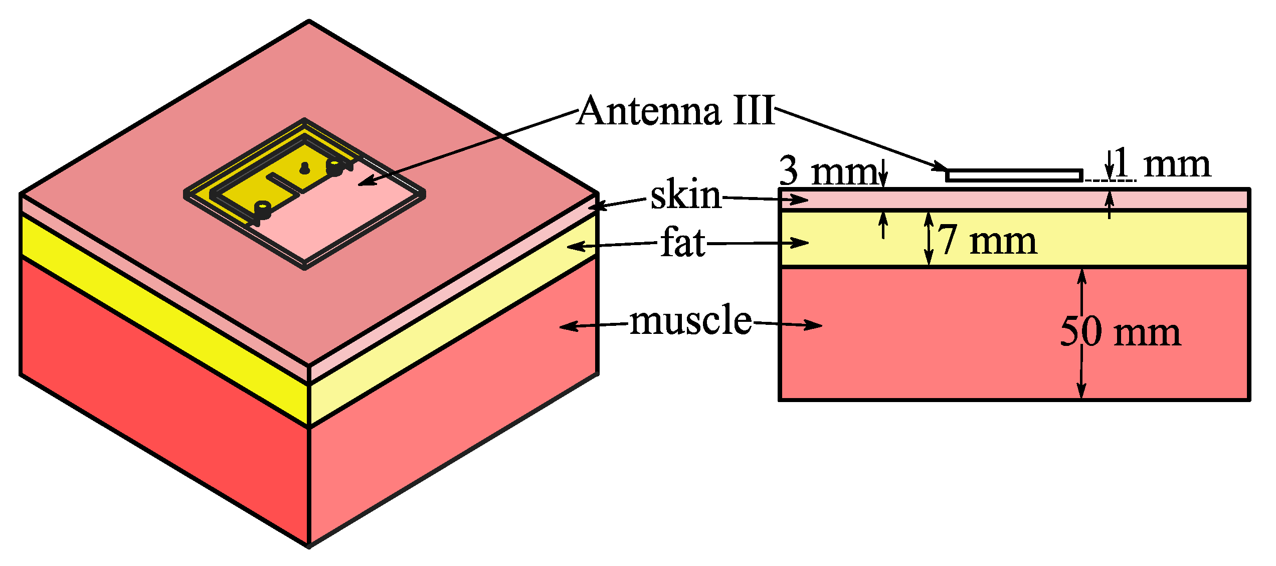 Micromachines 14 00934 g011 Micromachines 14 00934 g011
