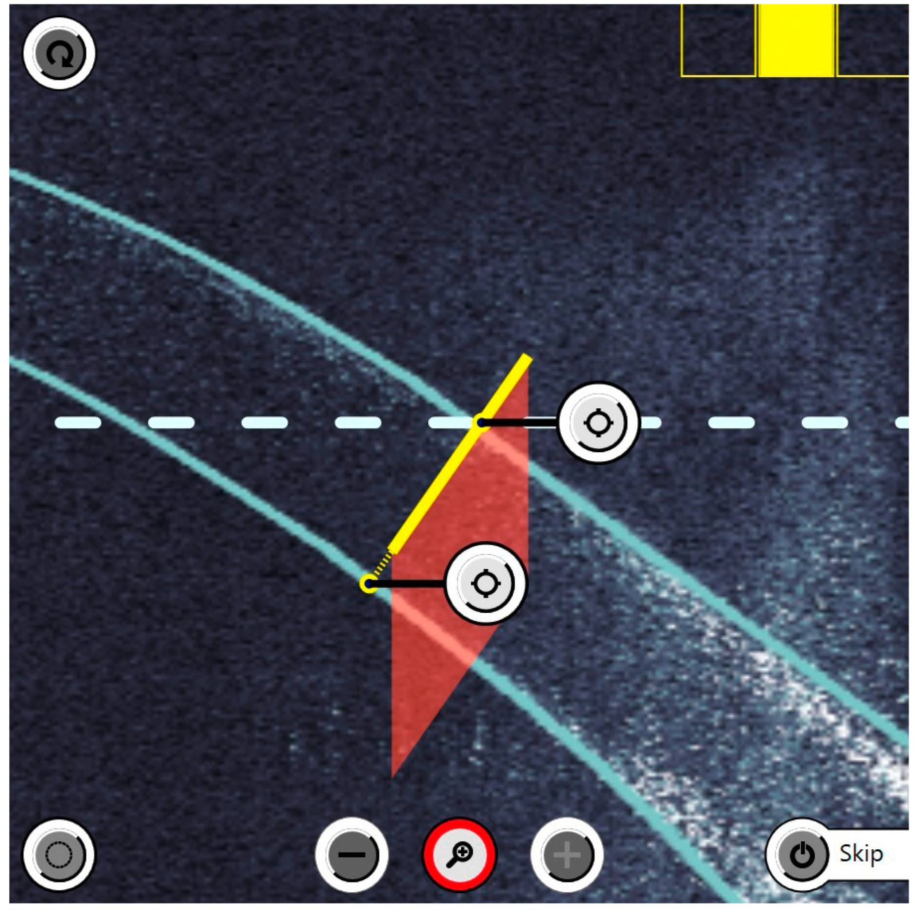 Micromachines 14 01009 g003