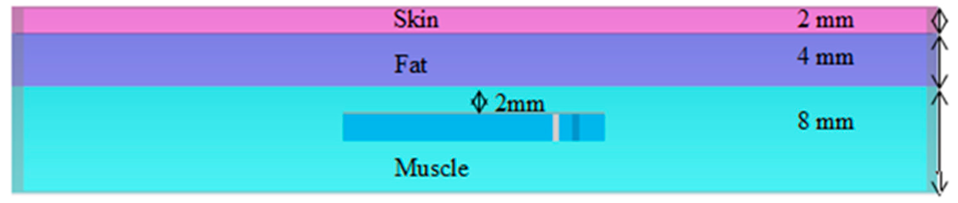Micromachines 14 01021 g002 Micromachines 14 01021 g002