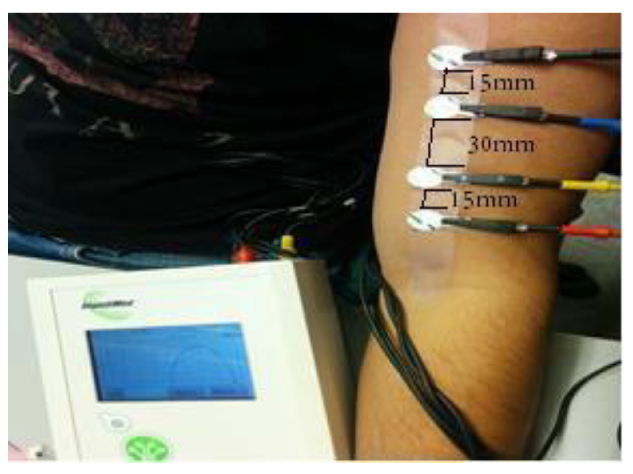 Micromachines 14 01179 g002