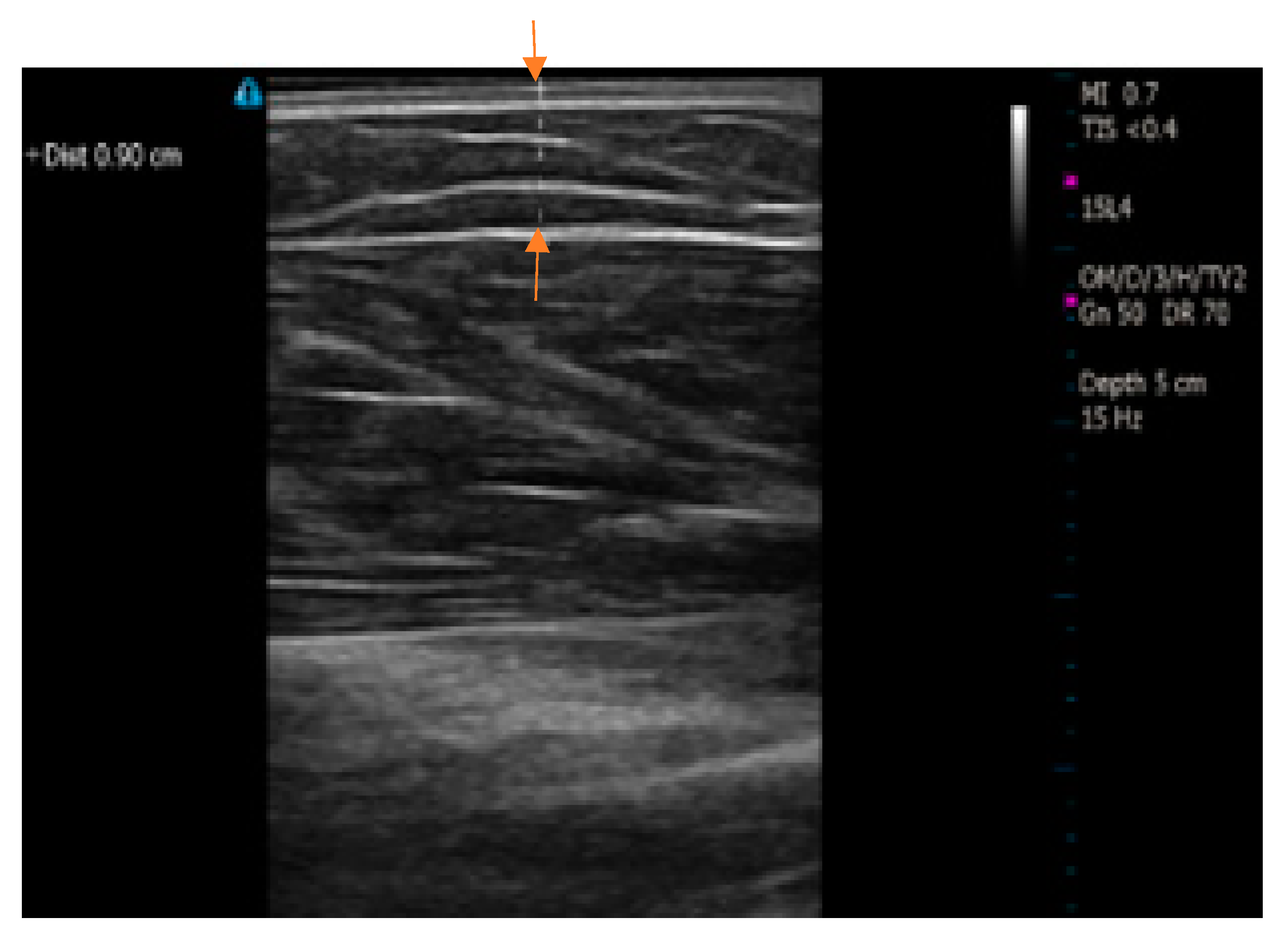 Micromachines 14 01179 g003