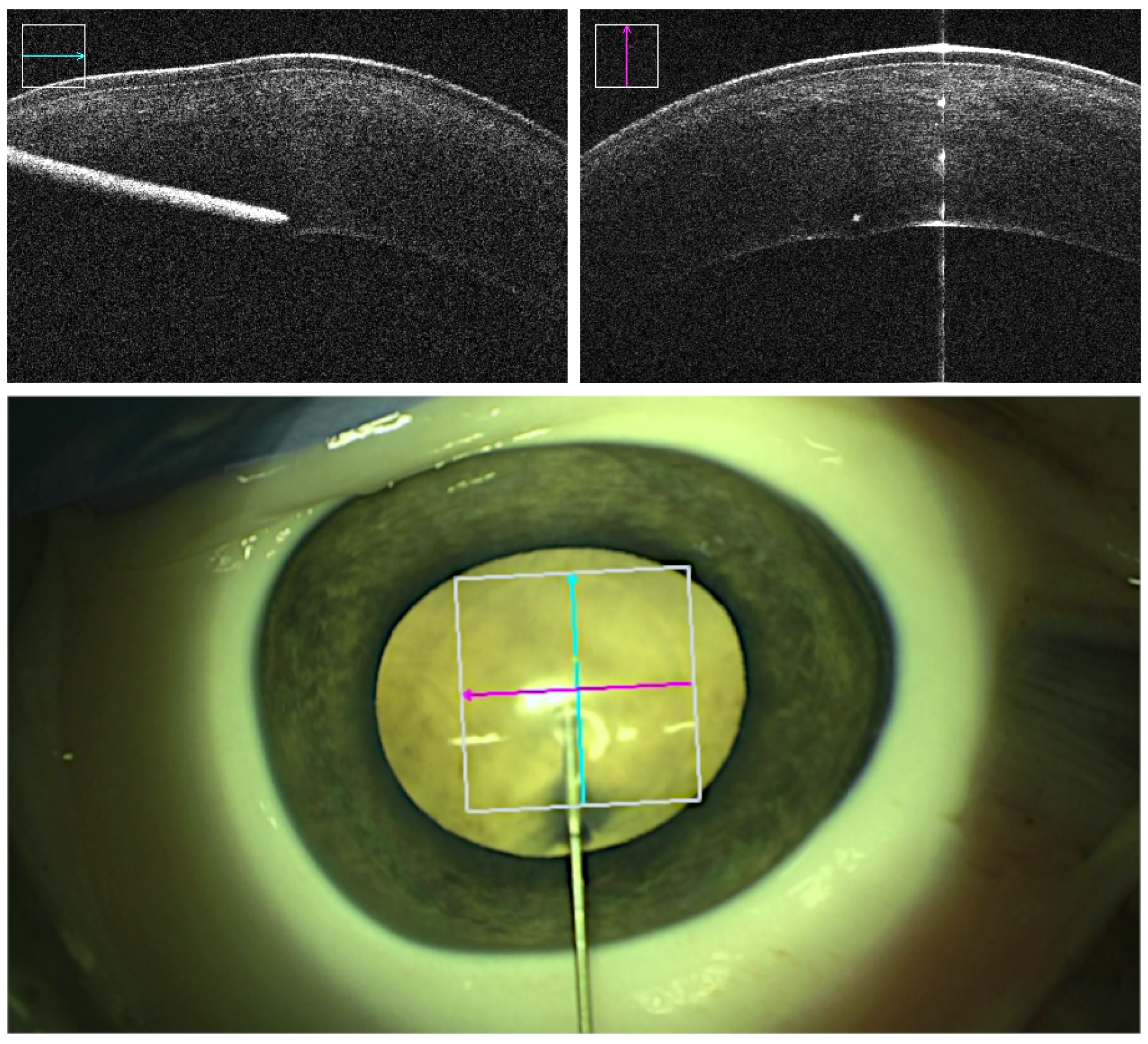 Micromachines 14 01261 g002 Micromachines 14 01261 g002