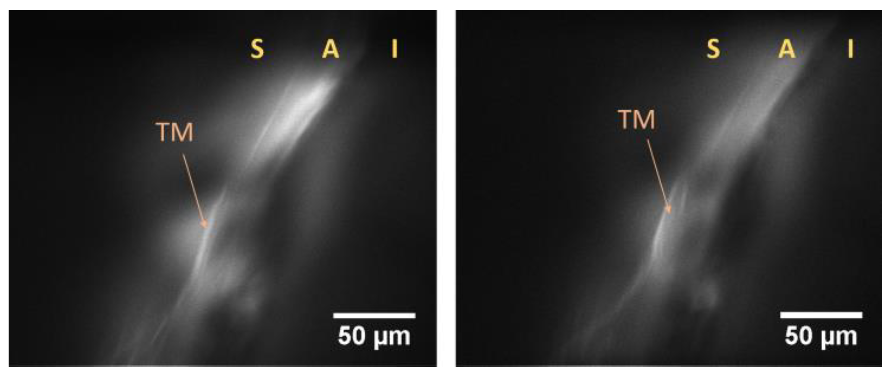 Micromachines 14 01672 g007