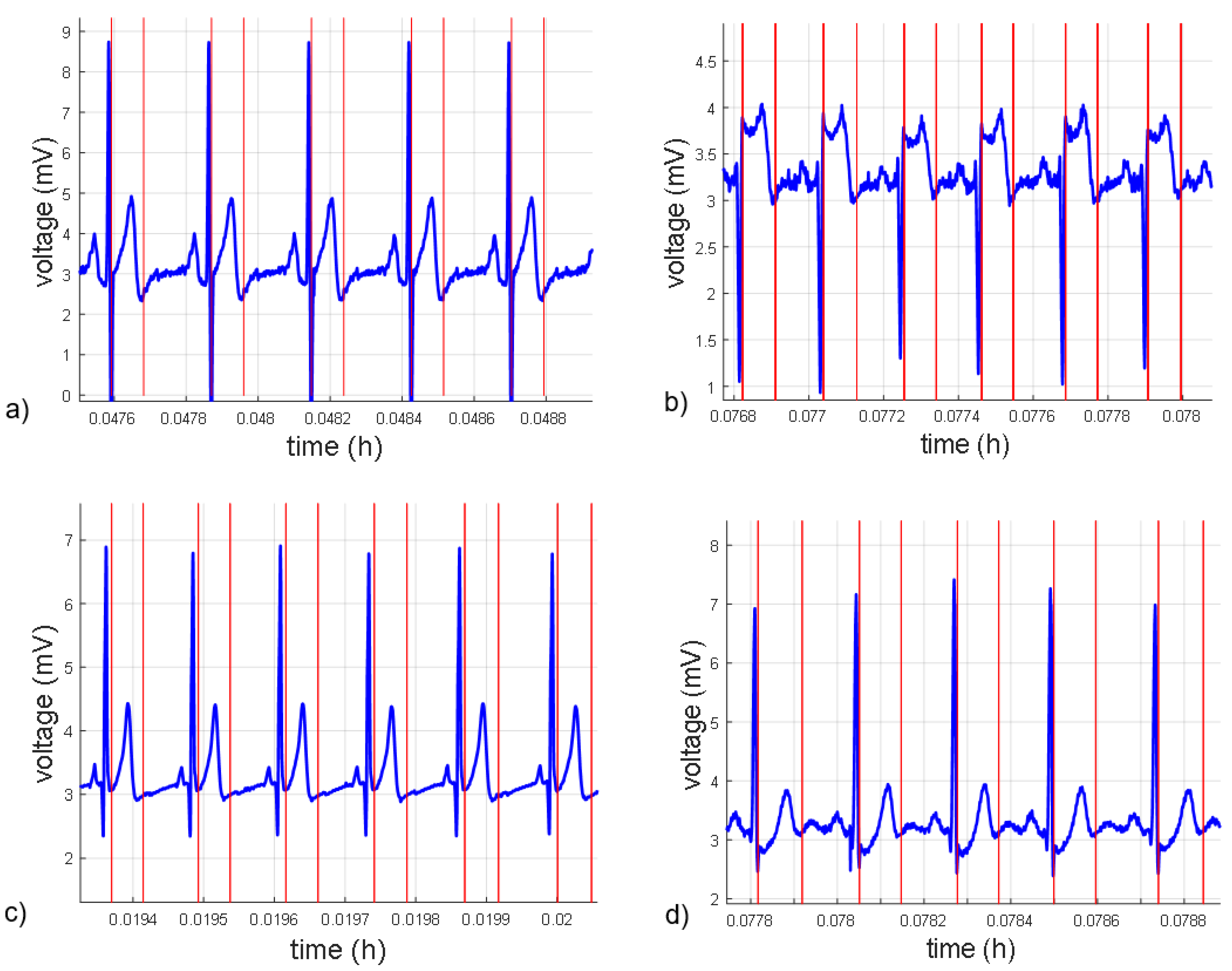 Micromachines 14 01748 g011