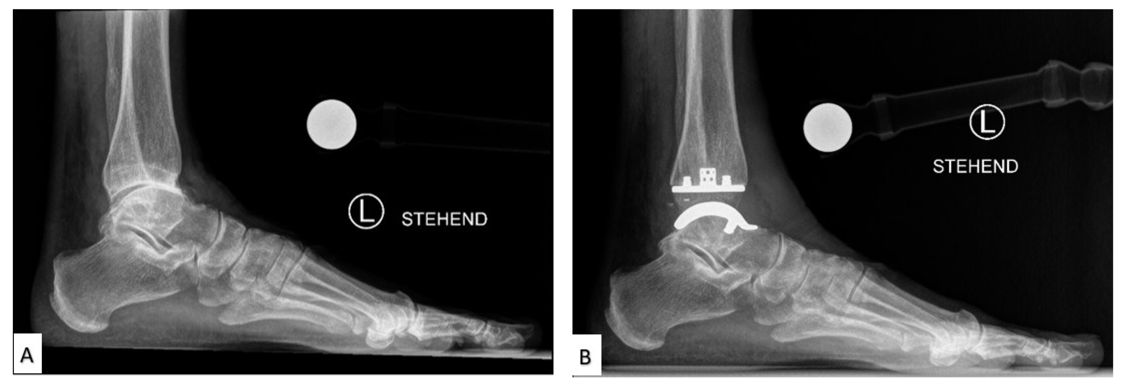 Micromachines 14 02081 g003